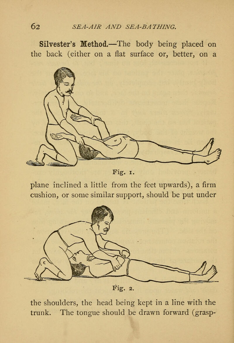 Silvester's Method.—The body being placed on the back (either on a flat surface or, better, on a Fig. I. plane inclined a little from the feet upwards), a firm cushion, or some similar support, should be put under Fig. 2. the shoulders, the head being kept in a line with the trunk. The tongue should be drawn forward (grasp-