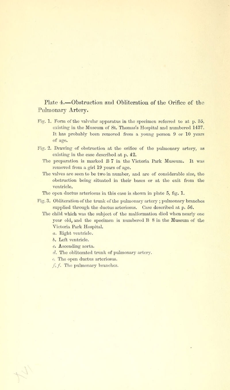 Plate 4,—Obstructiou aud Obliteration of the Orifice of the Pulmonary Artery. Fig, 1. Form of the valvular apparatus in the specimen referred to at p. 35, existing in the Museum of St. Thomas's Hosjpital and numbered 1437. It has probably been removed from a young person 9 or 10 years of age. Fig. 2. Drawing of obstruction at the orifice of the pulmonary artery, as existing in the case described at p. 42, The preparation is marked B 7 in the Victoria Park Museum. It was removed from a girl 19 years of age. The valves are seen to be two in number, and are of considerable size, the obstruction being situated in their bases or at the exit from the ventricle. The open ductus arteriosus in this case is shown in plate 5, fig. 1. Fig. 3. Obliteration of the trunk of the pulmonary artoiy ; pulmonary branches supplied through the ductus arteriosus. Case described at p. 56. The child which was the subject of the malformation died when nearly one year old, and the specimen is numbered B 8 in the Museum of the Victoria Park Hospital. a. Right ventricle. b. Left ventricle. c. Ascending aorta. d. The obliterated trunk of pulmonary artery. e. The open ductus arteriosus, /, /. The pulmonary branches.