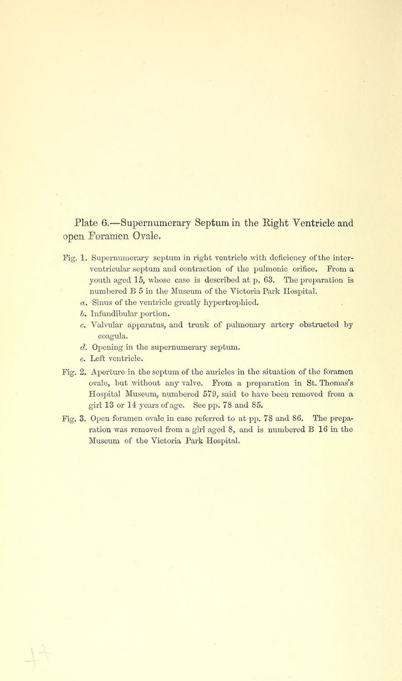 Plate 6.—Supernumerary Septum in the Eight Ventricle and open Foramen Ovale. Fig. 1. Supernumerary septum in right ventricle with deficiency of the inter- ventricular septum and contraction of the pulmonic orifice. From a youth aged 15, whose case is described at p. 63. The preparation is numbered B 5 in the Museum of the Victoria Park Hospital. a. Sinus of the ventricle greatly hypertroj^hiod. b. Infundibular portion. c. Valvular apparatus, and trunk of pulmonaiy artery obstructed by coagula. d. Opening in the supernumerary septum. e. Left ventricle. Fig. 2, Aperture in the septum of the auricles in the situation of the foramen ovale, but without any valve. From a preparation in St. Thomas's Hosjiital Museum, numbered 579, said to have been removed from a girl 13 or 14 years of age. See pp. 78 and 85. Fig. 3. Open foramen ovale in case referred to at pp. 78 and 86. The prepa- ration was removed from a girl aged 8, and is numbered B 16 in the Museum of the Victoria Park Hospital.