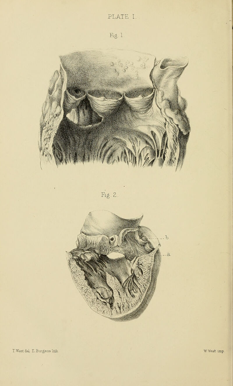 PLATE I. ea. 1. F16.2. a T.mstdel E.BurgeasTiGi.^ V? If est Tjnp.