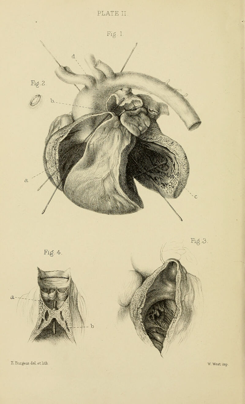 Fig.L \ Fi^ 2 Fi^.4. a—-_. EB-dTiSess iel.etlitb W West inrp.