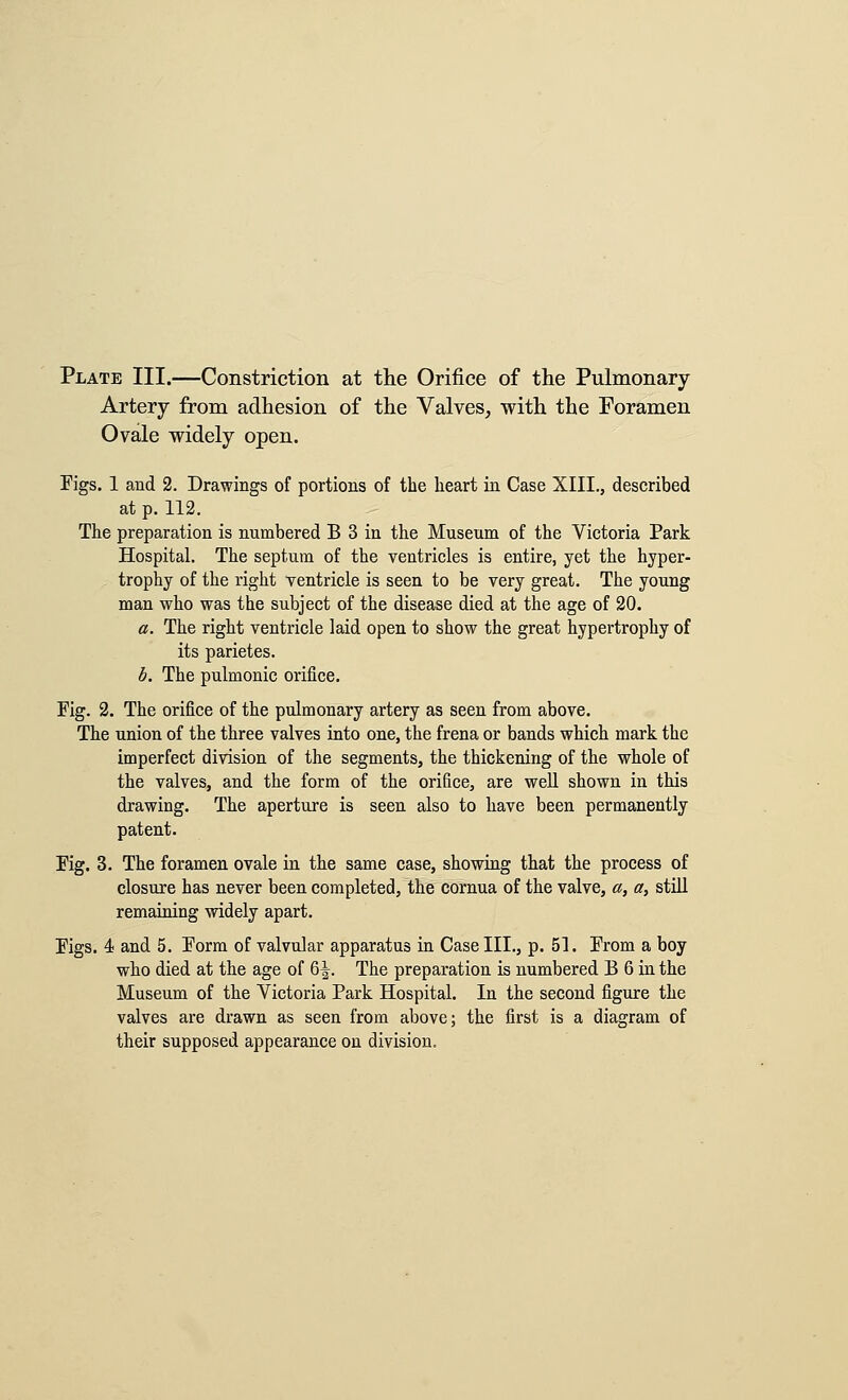 Plate III.—Constriction at the Orifice of the Pulmonary Artery from adhesion of the Valves, with the Foramen Ovale widely open. rigs. 1 and 2. Drawings of portions of the heart in Case XIII., described at p. 112. The preparation is numbered B 3 in the Museum of the Victoria Park Hospital. The septum of the ventricles is entire, yet the hyper- trophy of the right ventricle is seen to be very great. The young man who was the subject of the disease died at the age of 20. a. The right ventricle laid open to show the great hypertrophy of its parietes. b. The pulmonic orifice. Fig. 2. The orifice of the pulmonary artery as seen from above. The union of the three valves into one, the frena or bands which mark the imperfect division of the segments, the thickening of the whole of the valves, and the form of the orifice, are weU shown in this drawing. The aperture is seen also to have been permanently patent. Fig. 3. The foramen ovale in the same case, showing that the process of closure has never been completed, the cornua of the valve, a, a, stiU remaining widely apart. Figs. 4 and 5. Form of valvular apparatus in Case III., p. 51. From a boy who died at the age of 6^. The preparation is numbered B 6 in the Museum of the Victoria Park Hospital. In the second figure the valves are drawn as seen from above; the first is a diagram of their supposed appearance on division.