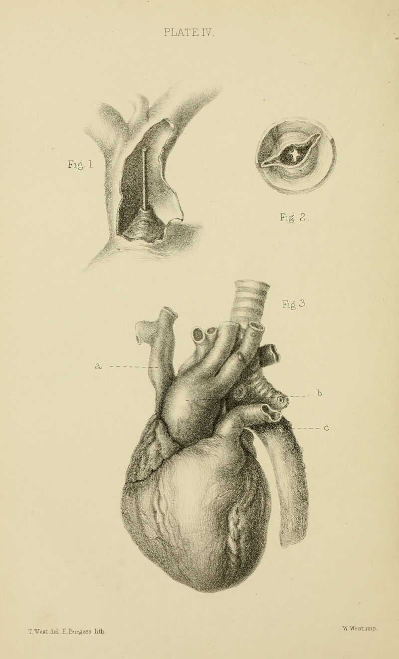 FiA-1 V$ i Fitf 2 a 'ifsSf-^' T.Vest ael.EBiirAess lith.