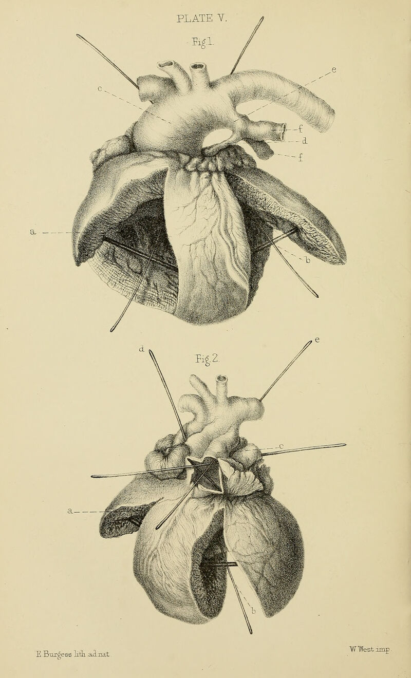 E Bxirgess liili .axLnat WWestunp.