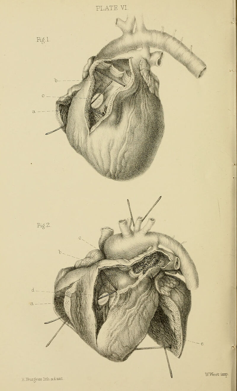 ' u #f E.BTir^ess liti ainai W.Westiinp