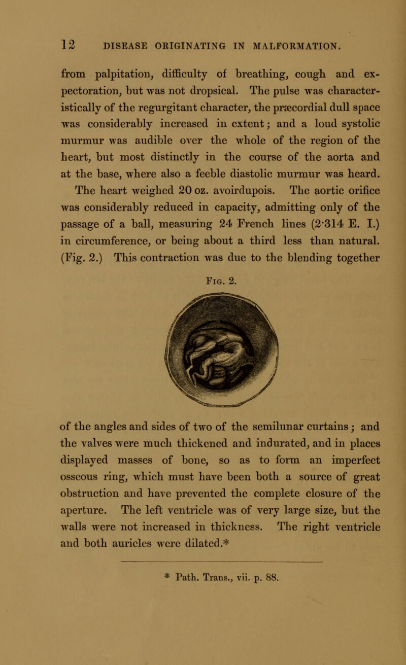 from palpitation, difficulty of breathing, cough and ex- pectoration, but was not dropsical. The pulse was character- istically of the regurgitant character, the precordial dull space was considerably increased in extent; and a loud systolic murmur was audible over the whole of the region of the heart, but most distinctly in the course of the aorta and at the base, where also a feeble diastolic murmur was heard. The heart weighed 20 oz. avoirdupois. The aortic orifice was considerably reduced in capacity, admitting only of the passage of a ball, measuring 24 French lines (2*314 E. I.) in circumference, or being about a third less than natural. (Fig. 2.) This contraction was due to the blending together Fig. 2. of the angles and sides of two of the semilunar curtains; and the valves were much thickened and indurated, and in places displayed masses of bone, so as to form an imperfect osseous ring, which must have been both a source of great obstruction and have prevented the complete closure of the aperture. The left ventricle was of very large size, but the walls were not increased in thickness. The right ventricle and both auricles were dilated.*