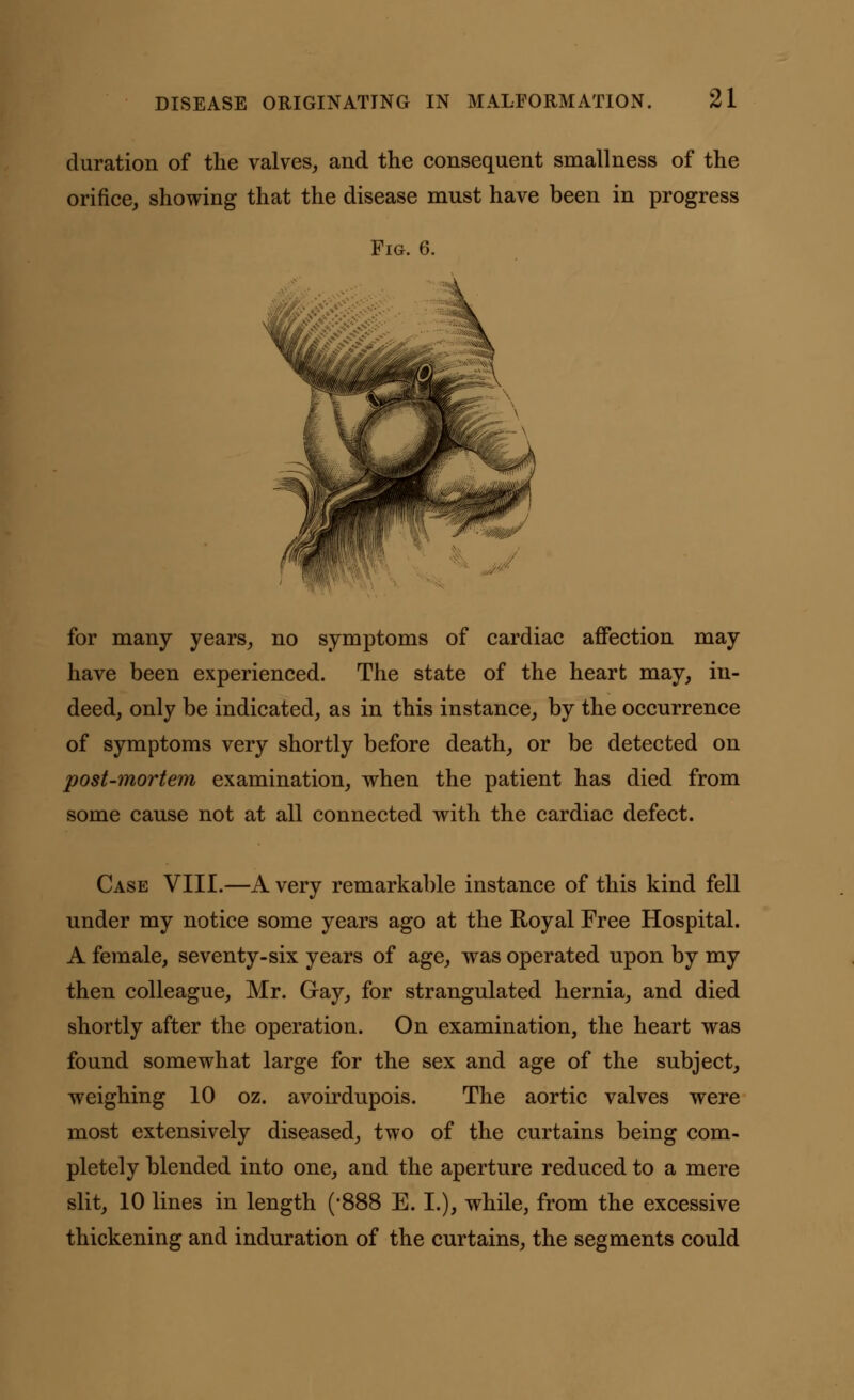 duration of the valves, and the consequent small ness of the orifice, showing that the disease must have been in progress Fig. 6. for many years, no symptoms of cardiac affection may have been experienced. The state of the heart may, in- deed, only be indicated, as in this instance, by the occurrence of symptoms very shortly before death, or be detected on post-mortem examination, when the patient has died from some cause not at all connected with the cardiac defect. Case VIII.—A very remarkable instance of this kind fell under my notice some years ago at the Royal Free Hospital. A female, seventy-six years of age, was operated upon by my then colleague, Mr. Gay, for strangulated hernia, and died shortly after the operation. On examination, the heart was found somewhat large for the sex and age of the subject, weighing 10 oz. avoirdupois. The aortic valves were most extensively diseased, two of the curtains being com- pletely blended into one, and the aperture reduced to a mere slit, 10 lines in length ('%&& E. I.), while, from the excessive thickening and induration of the curtains, the segments could