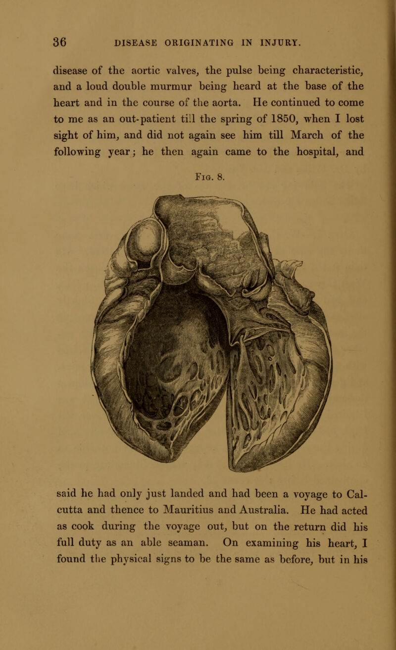 disease of the aortic valves, the pulse being characteristic, and a loud double murmur being heard at the base of the heart and in the course of the aorta. He continued to come to me as an out-patient till the spring of 1850, when I lost sight of him, and did not again see him till March of the following year; he then again came to the hospital, and Fig. 8. said he had only just landed and had been a voyage to Cal- cutta and thence to Mauritius and Australia. He had acted as cook during the voyage out, but on the return did his full duty as an able seaman. On examining his heart, I found the physical signs to be the same as before, but in his