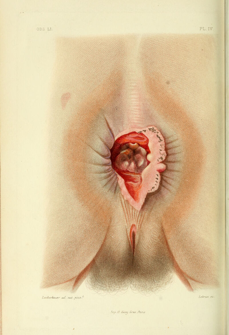 // Ovtiif' Gros Parts