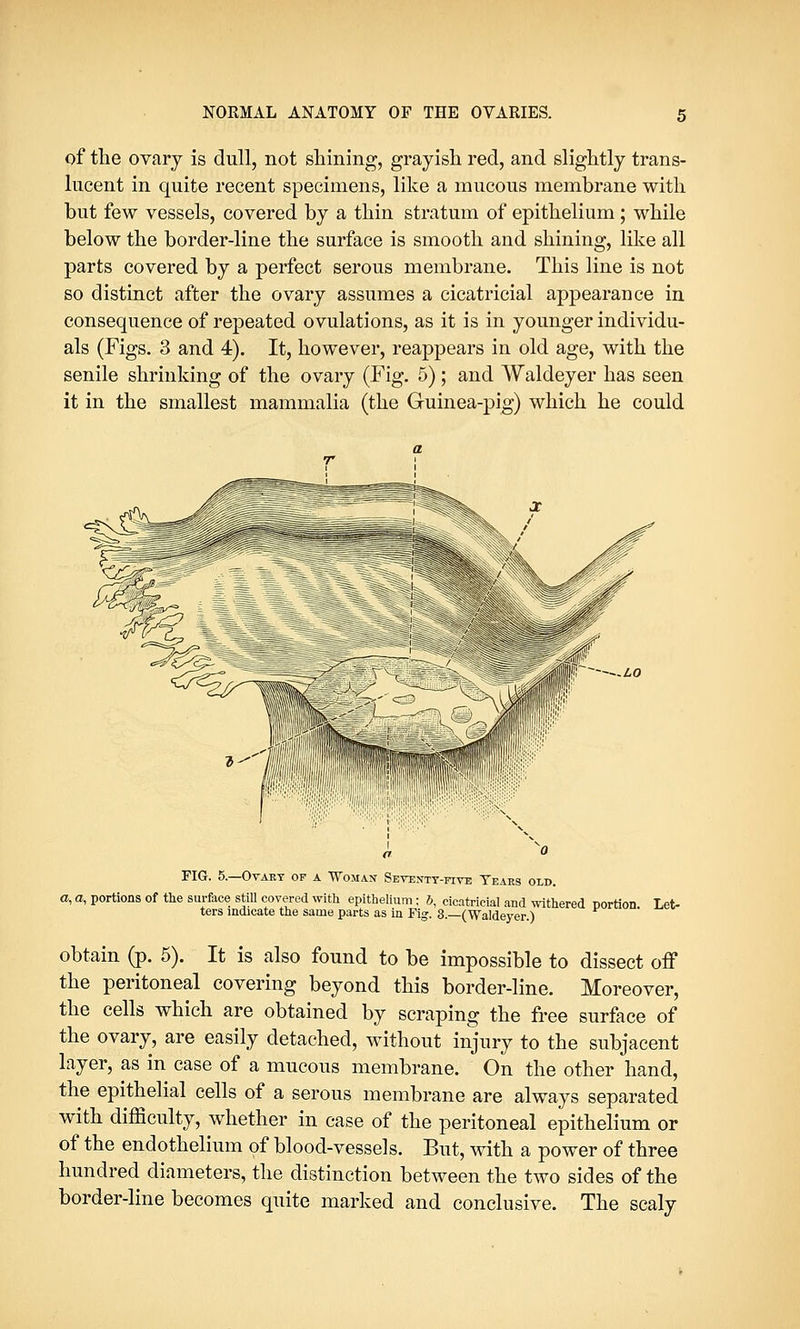 of the ovary is dull, not shining, grayish red, and slightly trans- lucent in quite recent specimens, like a mucous membrane with but few vessels, covered by a thin stratum of epithelium; while below the border-line the surface is smooth and shining, like all parts covered by a perfect serous membrane. This line is not so distinct after the ovary assumes a cicatricial appearance in consequence of repeated ovulations, as it is in younger individu- als (Figs. 3 and 4). It, however, reappears in old age, with the senile shrinking of the ovary (Fig. 5); and Waldeyer has seen it in the smallest mammalia (the Guinea-pig) which he could FIG. 5.—Ovary of a Woman Seventy-five Tears old. a, a, portions of the surface still covered with epithelium; 5, cicatricial and withered portion. Let- ters indicate the same parts as in Fig. 3.—(Waldeyer.) obtain (p. 5). It is also found to be impossible to dissect off the peritoneal covering beyond this border-line. Moreover, the cells which are obtained by scraping the free surface of the ovary, are easily detached, without injury to the subjacent layer, as in case of a mucous membrane. On the other hand, the epithelial cells of a serous membrane are always separated with difficulty, whether in case of the peritoneal epithelium or of the endothelium of blood-vessels. But, with a power of three hundred diameters, the distinction between the two sides of the border-line becomes quite marked and conclusive. The scaly
