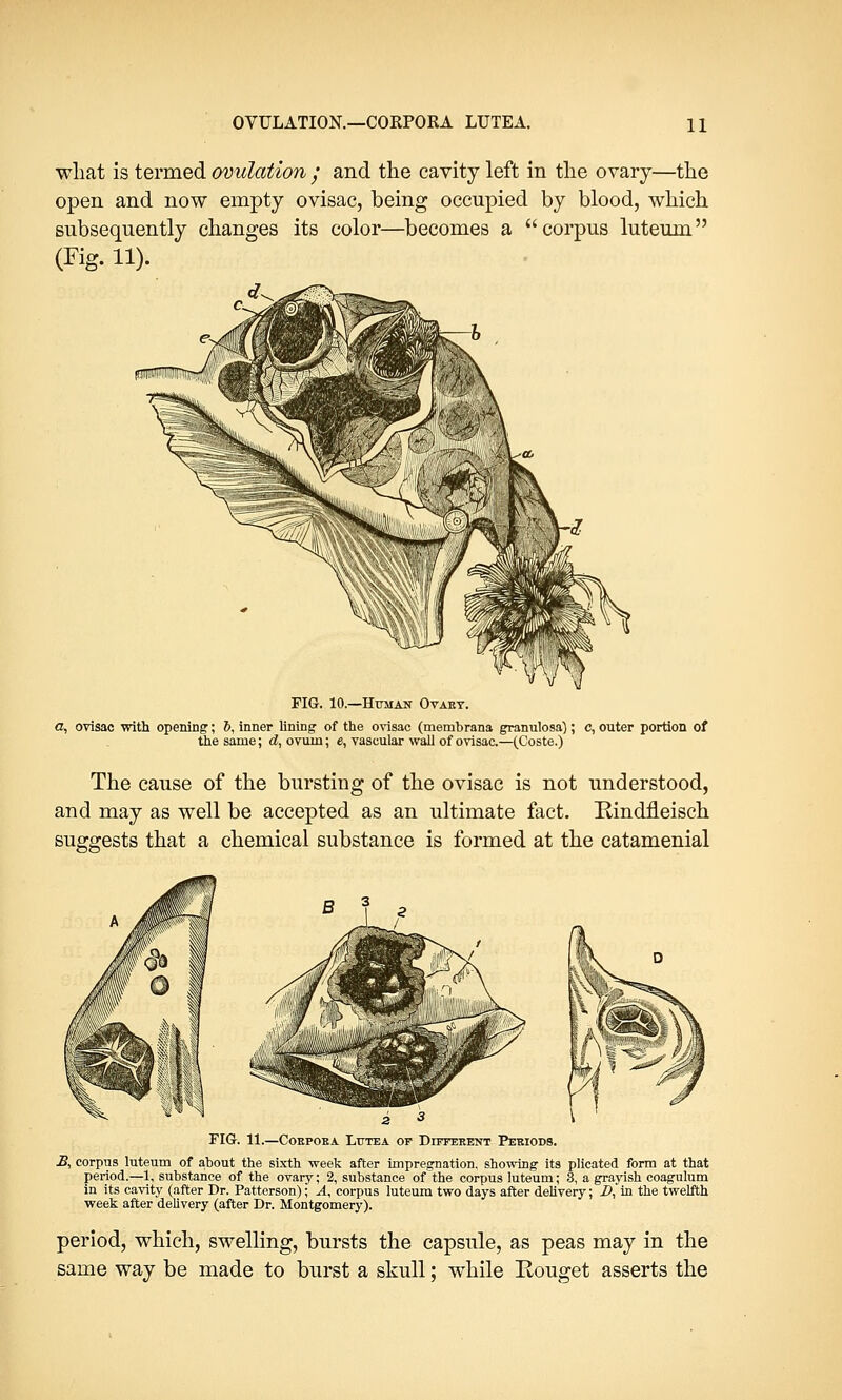 what is termed ovulation • and the cavity left in the ovary—the open and now empty ovisac, being occupied by blood, which subsequently changes its color—becomes a corpus luteum (Fig. 11). FIG. 10.—Human Ovary. a, ovisac with opening; 6, inner lining of the ovisac (membrana granulosa); c, outer portion of the same; d, ovum; e, vascular wall of ovisac.—(Coste.) The cause of the bursting of the ovisac is not understood, and may as well be accepted as an ultimate fact. Kindfleisch suggests that a chemical substance is formed at the catamenial 3 \ FIG. 11.—Corpora Littea or Different Periods. B, corpus luteum of about the sixth week after impregnation, showing its plicated form at that period.—1, substance of the ovary; 2, substance of the corpus luteum; 3, a grayish coagulum in its cavity (after Dr. Patterson); A, corpus luteum two days after delivery; 2>, in the twelfth week after delivery (after Dr. Montgomery). period, which, swelling, bursts the capsule, as peas may in the same way be made to burst a skull; while Eouget asserts the