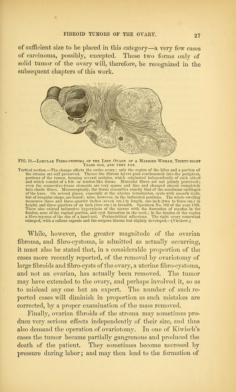 of sufficient size to be placed in this category—a very few cases of carcinoma, possibly, excepted. These two forms only of solid tumor of the ovary will, therefore, be recognized in the subsequent chapters of this work. FIG. 18.—Lobular Fibro-cystoma of the Left Ovary of a Married Woman, Thirty-eigih Tears old, and very fat. Vertical section.—The change affects the entire ovary; only the region of the hihis and a portion of the stroma are still preserved. Thence the fibrous layers pass continuously into the periphera, portions of the tumor, forming several nodules, which originated independently of each otherl and which consist of a felt- or tendon-like tissue. Muscular fibres are not plainly perceived; even the connective-tissue elements are very sparse and fine, and changed almost completely into elastic fibres. Microscopically, the tissue resembles exactly that of the semilunar cartilages of the knee. On several places, especially at the uterine termination, cysts with smooth walls, but of irregular shape, are found ; none, however, in the indurated portions. The whole swelling measures three and three-quarter inches (seven em.) in length, one inch (two to three cm.) in height, and three quarters of an inch (two cm.) in breadth. Specimen No. 102 of the year 1863. There also existed indurative hyperplasia of the uterus with the formation of myoma in the fundus, acne of the vaginal portion, and cyst formation in the neck; in the fundus of the vagina a fibro-myoma of the size of a hazel-nut. Perimetritical adhesions. The right ovary somewhat enlarged, with a callous capsule and the corpora fibrosa but slightly developed.—(Virchow.) While, however, the greater magnitude of the ovarian fibroma, and fibro-cystoma, is admitted as actually occurring, it must also be stated that, in a considerable proportion of the cases more recently reported, of the removal by ovariotomy of large fibroids and fibro-cysts of the ovary, a uterine fibro-cystoma, and not an ovarian, has actually been removed. The tumor may have extended to the ovary, and perhaps involved it, so as to mislead any one but an expert. The number of such re- ported cases will diminish in proportion as such mistakes are corrected, by a proper examination of the mass removed. Finally, ovarian fibroids of the stroma may sometimes pro- duce very serious effects independently of their size, and thus also demand the operation of ovariotomy. In one of Kiwisch's cases the tumor became partially gangrenous and produced the death of the patient. They sometimes become necrosed by pressure during labor; and may then lead to the formation of