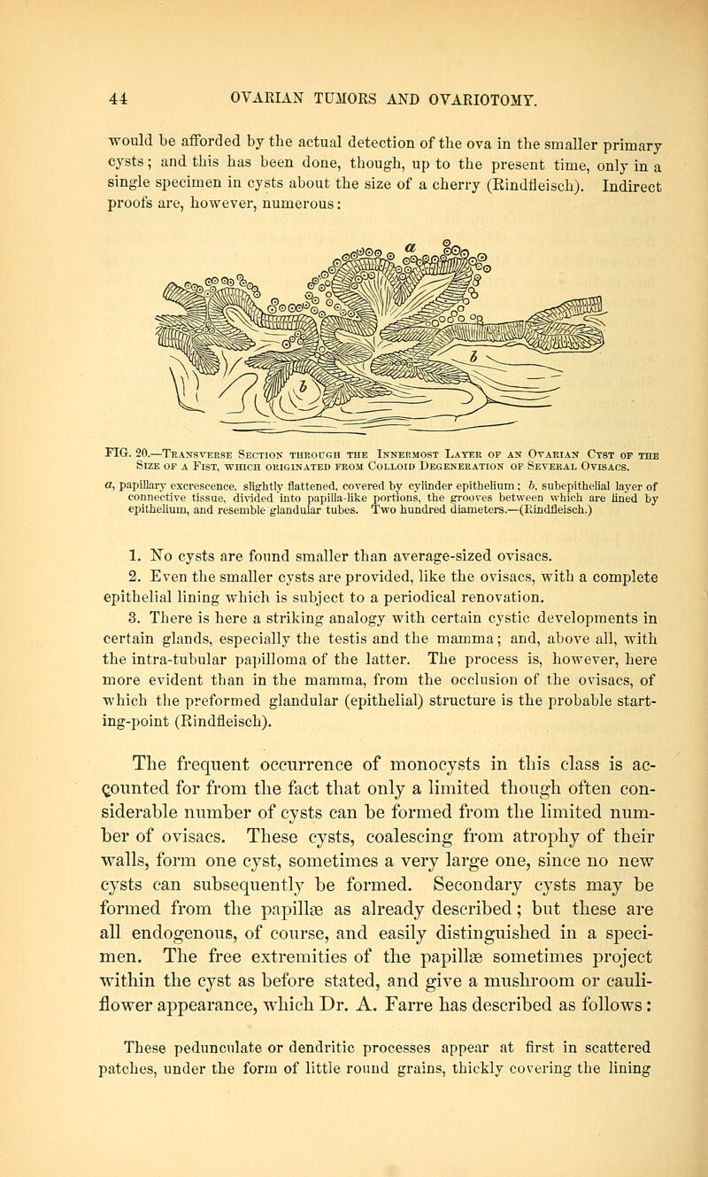 would be afforded by the actual detection of the ova in the smaller primary cysts; and this has been done, though, up to the present time, only in a single specimen in cysts about the size of a cherry (Rindfieisch). Indirect proofs are, however, numerous: FIG. 20.—Transverse Section through the Innermost Later op an Ovarian Cyst of the Size of a Fist, which originated from Colloid Degeneration of Several Ovisacs. a, papillary excrescence, slightly flattened, covered by cylinder epithelium ; b, subepithelial layer of connective tissue, divided into papilla-like portions, the grooves between which are lined by epithelium, and resemble glandular tubes. Two hundred diameters.—(Eindfleisch.) 1. No cysts are found smaller than average-sized ovisacs. 2. Even the smaller cysts are provided, like the ovisacs, with a complete epithelial lining which is subject to a periodical renovation. 3. There is here a striking analogy with certain cystic developments in certain glands, especially the testis and the mamma; and, above all, with the intra-tubular papilloma of the latter. The process is, however, here more evident than in the mamma, from the occlusion of the ovisacs, of which the preformed glandular (epithelial) structure is the probable start- ing-point (Rindfieisch). The frequent occurrence of monocysts in this class is ac- counted for from the fact that only a limited though often con- siderable number of cysts can be formed from the limited num- ber of ovisacs. These cysts, coalescing from atrophy of their walls, form one cyst, sometimes a very large one, since no new cysts can subsequently be formed. Secondary cysts may be formed from the papillae as already described; but these are all endogenous, of course, and easily distinguished in a speci- men. The free extremities of the papillae sometimes project within the cyst as before stated, and give a mushroom or cauli- flower appearance, which Dr. A. Farre has described as follows: These pedunculate or dendritic processes appear at first in scattered patches, under the form of little round grains, thickly covering the lining