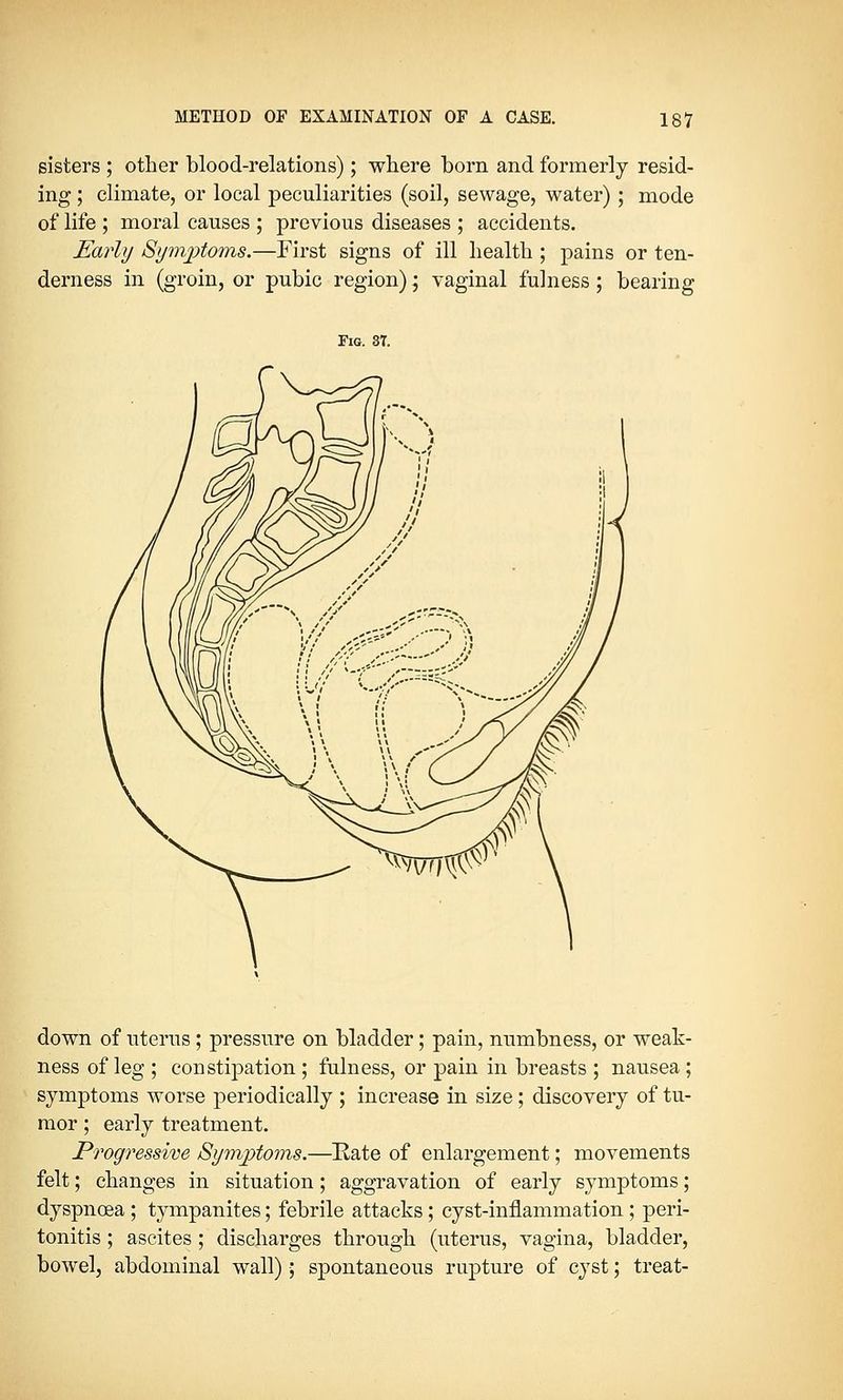 sisters ; other blood-relations); where born and formerly resid- ing ; climate, or local peculiarities (soil, sewage, water); mode of life ; moral causes ; previous diseases ; accidents. Early Symptoms.—First signs of ill health ; pains or ten- derness in (groin, or pubic region); vaginal fulness; bearing Fig. 37. down of uterus; pressure on bladder; pain, numbness, or weak- ness of leg ; constipation ; fulness, or pain in breasts ; nausea ; symptoms worse periodically ; increase in size; discovery of tu- mor ; early treatment. Progressive Symptoms.—Rate of enlargement; movements felt; changes in situation; aggravation of early symptoms; dyspnoea ; tympanites; febrile attacks; cyst-inflammation ; peri- tonitis ; ascites ; discharges through (uterus, vagina, bladder, bowel, abdominal wall); spontaneous rupture of cyst; treat-