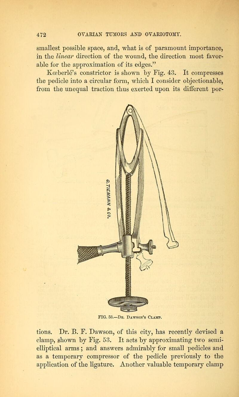 smallest possible space, and, what is of paramount importance, in the linear direction of the wound, the direction most favor- able for the approximation of its edges. Kceberle's constrictor is shown by Fig. 43. It compresses the pedicle into a circular form, which I consider objectionable, from the unequal traction thus exerted upon its different por- FIG. 53.—De. Dawson's Clamp. tions. Dr. B. F. Dawson, of this city, has recently devised a clamp, shown by Fig. 53. It acts by approximating two semi- elliptical arms; and answers admirably for small pedicles and as a temporary compressor of the pedicle previously to the application of the ligature. Another valuable temporary clamp