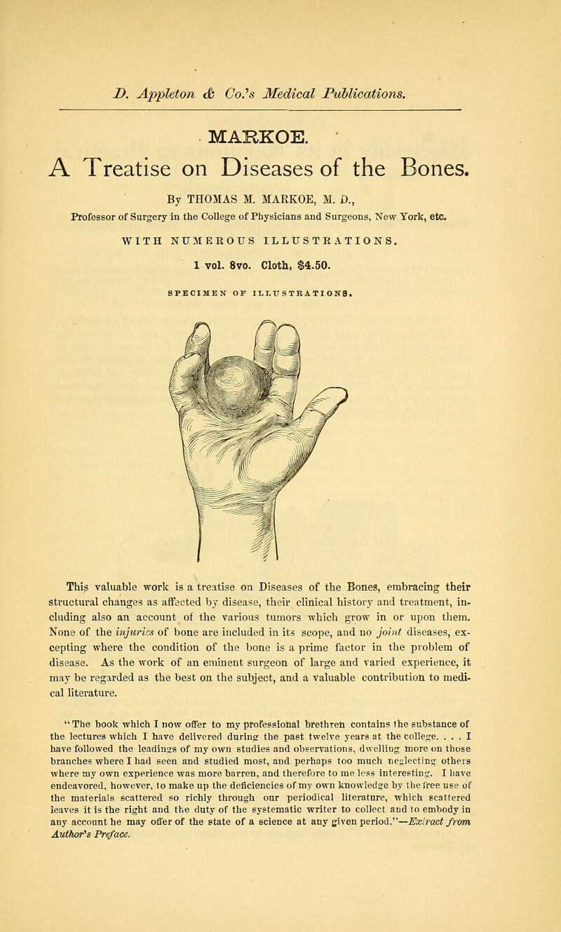 MAKKOE. A Treatise on Diseases of the Bones. By THOMAS M. HARKOE, M. D., Professor of Surgery in the College of Physicians and Surgeons, New York, etc. WITH NUMEROUS ILLUSTRATIONS. 1 vol. 8vo. Cloth, $4.50. SPECIMEN OF ILLUSTRATIONS. This valuable work is a treatise on Diseases of the Bones, embracing their structural changes as affected by disease, their clinical history and treatment, in- cluding also an account of the various tumors which grow in or upon them. None of the injuries of bone are included in its scope, and no joint diseases, ex- cepting where the condition of the bone is a prime factor in the problem of disease. As the work of an eminent surgeon of large and varied experience, it may be regarded as the best on the subject, and a Valuable contribution to medi- cal literature. The book which I now offer to my professional brethren contains ihe substance of the lectures which I have delivered during the past twelve years at the college. ... I have followed the leadings of my own studies and observations, dwelling more on those branches where I had seen and studied most, and perhaps too much neglecting others where my own experience was more barren, and therefore to me less interesting. I have endeavored, however, to make up the deficiencies of my own knowledge by the free use of the materials scattered so richly through our periodical literature, which scattered leaves it is the right and the duty of the systematic writer to collect and to embody in any account he may offer of the state of a science at any given period.—Extract from Author's Preface.