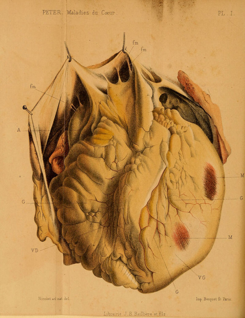 PETER. Maladies du Coeur VL. I .M Nicoiet ad nat del Imp . B ecmiet fr. îkri litraine J.E. Bailli ère et fils