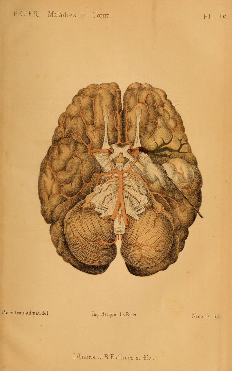 PETER. Maladies du Coeur. PL . IV. Parenteau. aànat.del. Imp-Beccpiet fr.Paris. Nicolet litti. LiWirie J.B. Bailli ère et fil<