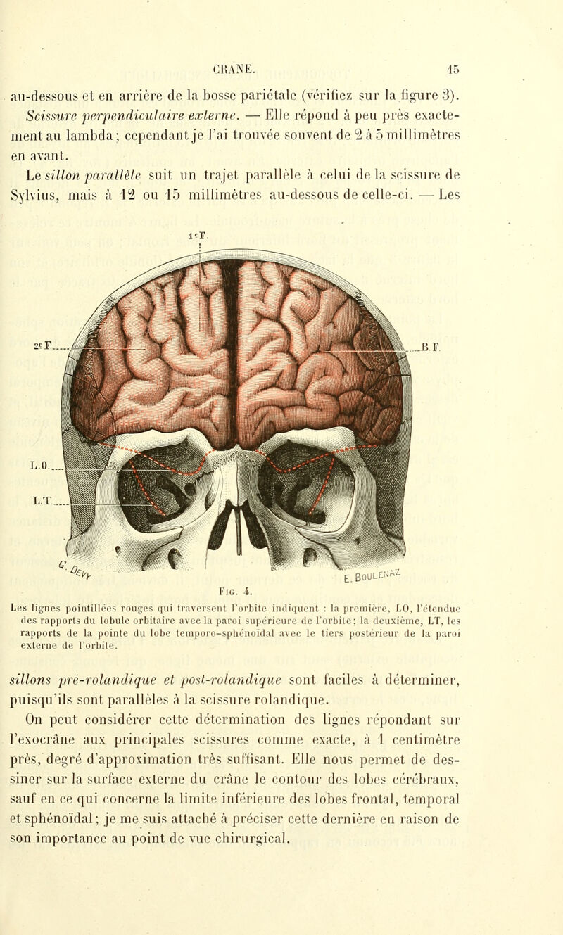 au-dessous et en arrière de la bosse pariétale (vérifiez sur la figure 3). Scissure perpendiculaire externe. — Elle répond à peu près exacte- ment au lambda ; cependant je l'ai trouvée souvent de 2 à 5 millimètres en avant. Le sillon parallèle suit un trajet parallèle à celui de la scissure de Sylvius, mais à 12 ou 15 millimètres au-dessous de celle-ci.—Les içp. 2çr L.O.. L.T. . .BF. BOULttslfV'^ FlG. i. Les lignes pointillées rouges qui traversent l'orbite indiquent : la première, LO, l'étendue des rapports du lobule orbitaire avec la paroi supérieure de l'orbile; la deuxième, LT, les rapports de la pointe du lobe temporo-sphénoïdal avec le tiers postérieur de la paroi externe de l'orbite. sillons pré-rolandique et post-rolandique sont faciles à déterminer, puisqu'ils sont parallèles à la scissure rolandique. On peut considérer cette détermination des lignes répondant sur l'exocrâne aux principales scissures comme exacte, à 1 centimètre près, degré d'approximation très suffisant. Elle nous permet de des- siner sur la surface externe du crâne le contour des lobes cérébraux, sauf en ce qui concerne la limite inférieure des lobes frontal, temporal et sphénoïdal; je me suis attaché h préciser cette dernière en raison de son importance au point de vue chirurgical.