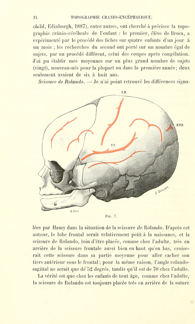 child, Edinbiirg-h, 1887), entre autres, ont cherché à préciser la topo- graphie crànio-cérébrale de l'enfant : le premier, élève de Broca, a expérimenté par le procédé des fiches sur quatre enfants d'un jour à un mois ; les recherches du second ont porté sur un nombre égal de sujets, par un procédé différent, celui des coupes après congélation. J'ai pu établir mes moyennes sur un plus grand nombre de sujets (vingt), nouveau-nés pour la plupart ou dans la première année; deux seulement avaient de six à huit ans. Scissure de Rolando. —• Je n'ai point retrouvé les différences signa- SP.O. FiG. 7. lées par Hamy dans la situation de la scissure âe Rolando. D'après cet auteur, le lobe frontal serait relativement petit à la naissance, et la scissure de Rolando, loin d'être placée, comme chez l'adulte, très en arrière de la scissure frontale aussi bien en haut qu'en bas, croise- rait cette scissure dans sa partie moyenne pour aller cacher son tiers antérieur sous le frontal ; pour la même raison, l'angle rolando- sagittal ne serait que de'52 degrés, tandis qu'il est de 70 chez l'adulte. La vérité est que chez les enfants de tout âge, comme chez l'adulte, la scissure de Rolando est toujours placée très en arrière de la suture