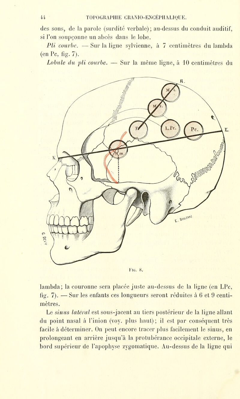 des sons, de la parole (surdité verbale); au-dessus du conduit auditif, si l'on soupçonne un abcès dans le lobe. PU courbe. — Sur la ligne sylvienne, à 7 centimètres du lambda (en Pc, fig. 7). Lobule du pli courbe. — Sur la même ligne, à 10 centimètres du Fig. 8. lambda; la couronne sera placée juste au-dessus de la ligne (en LPc, fig. 7). — Sur les enfants ces longueurs seront réduites à 6 et 9 centi- mètres. Le sinus latéral est sous-jacent au tiers postérieur de la ligne allant du point nasal à l'inion (voy. plus haut); il est par conséquent très facile à déterminer. On peut encore tracer plus facilement le sinus, en prolongeant en arrière jusqu'à la protubérance occipitale externe, le bord supérieur de l'apophyse zygomatique. Au-dessus de la ligne qui