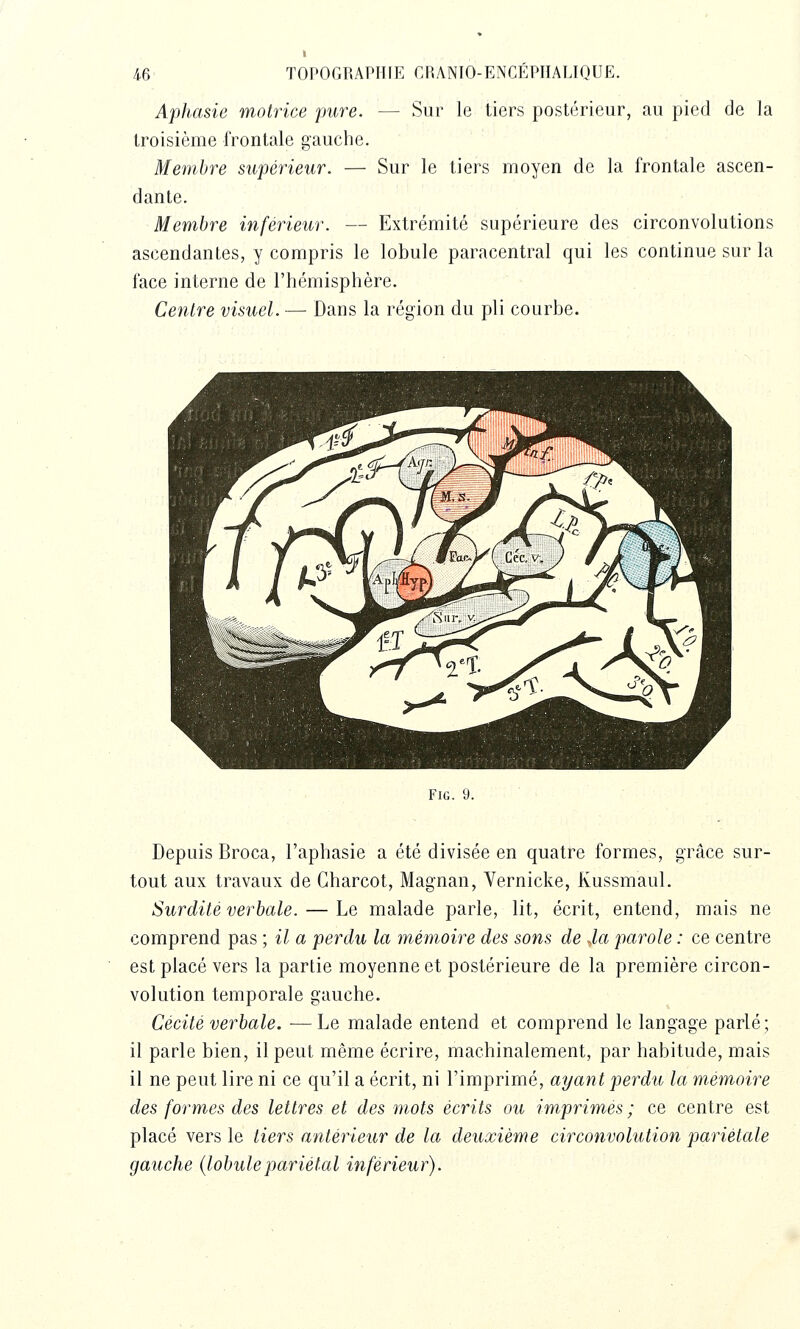 Sur le tiers postérieur, au pied de la Aphasie motrice pure. troisième frontale gauche. Membre supérieur. — Sur le tiers moyen de la frontale ascen- dante. Membre inférieur. — Extrémité supérieure des circonvolutions ascendantes, y compris le lobule paracentral qui les continue sur la face interne de l'hémisphère. '- Centre visuel. — Dans la région du pli courbe. FiG. 9. Depuis Broca, l'aphasie a été divisée en quatre formes, grâce sur- tout aux travaux de Gharcot, Magnan, Vernicke, Kussmaul. Surdité verbale. — Le malade parle, lit, écrit, entend, mais ne comprend pas ; il a perdu la mémoire des sons de M parole : ce centre est placé vers la partie moyenne et postérieure de la première circon- volution temporale gauche. Cécité verbale. — Le malade entend et comprend le langage parlé; il parle bien, il peut même écrire, machinalement, par habitude, mais il ne peut lire ni ce qu'il a écrit, ni l'imprimé, ayant perdu la mémoire des formes des lettres et des mots écrits ou imprimes ; ce centre est placé vers le tiers antérieur de la deuxième circonvolution pariétale gauche (lobulepariétal inférieur).