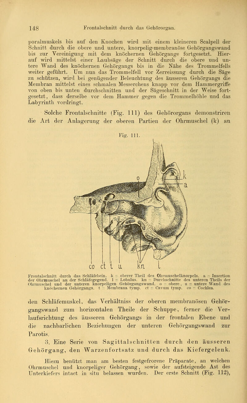 poralmuskels bis auf den Knochen wird mit einem kleineren Scalpell der Schnitt durch die obere und untere, knorpelig-membranöse Gehörgangs wand bis zur Vereinigung mit dem knöchernen Gehörgange fortgesetzt. Hier- auf wird mittelst einer Laubsäge der Schnitt durch die obere und un- tere Wand des knöchernen Gehörgangs bis in die Nähe des Trommelfells weiter geführt. Um nun das Trommelfell vor Zerreissung durch die Säge zu schützen, wird bei genügender Beleuchtung des äusseren Gehörgangs die Membran mittelst eines schmalen Messerchens knapp vor dem Hammergriffe von oben bis unten durchschnitten und der Sägeschnitt in der Weise fort- gesetzt, dass derselbe vor dem Hammer gegen die Trommelhöhle und das Labyrinth vordringt. Solche Frontabschnitte (Fig. 111) des Gehörorgans demonstriren die Art der Anlagerung der oberen Partien der Ohrmuschel (k) an Fig. 111. Frontalschnitt durch das Schläfebein, k - oberer Theil des Ohrmuschelknorpels. a - Insertion der Ohrmuschel an der Schläfegegend. 1 = Lobulus. kn = Durchschnitte des unteren Theils der Ohrmuschel und der unteren knorpeligen Gehörgangswand, o = obere , u — untere Wand des knöchernen Gehörgangs. t = Membrana tymp. et - Cavum tymp. co = Cochlea. den Schläfemuskel, das Verhältniss der oberen merabranösen Gehör- gangswand zum horizontalen Theile der Schuppe, ferner die Ver- laufsrichtung des äusseren Gehörgangs in der frontalen Ebene und die nachbarlichen Beziehungen der unteren Gehörgangswand zur Parotis. 3. Eine Serie von Sagittalschnitten durch den äusseren Gehörgang, den Warzenfortsatz und durch das Kiefergelenk. Hiezu benützt man am besten festgefrorene Präparate, an welchen Ohrmuschel und knorpeliger Gehörgang, sowie der aufsteigende Ast des Unterkiefers intact in situ belassen wurden. Der erste Schnitt (Fig. 112),