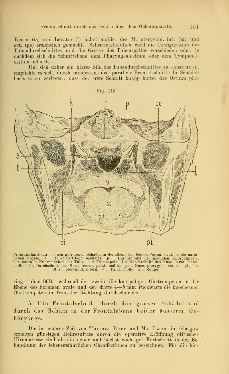 Tensor (ts) und Levator (1) palati mollis, des M. pterygoid. int. (pi) und ext. (pe) ersichtlich gemacht. Selbstverständlich wird die Configuration des Tubendurchschnittes und die Grösse des Tubenspaltes verschieden sein, je nachdem sich die Schnittebene dem Pharyngealostium oder dem Tympanal- ostium nähert. Um sich daher ein klares Bild des Tubendurcbschnittes zu construiren, empfiehlt es sich, durch mindestens drei parallele Frontalschnitte die Schädel- basis so zu zerlegen, dass der erste Schnitt knapp hinter das Ostium pha- Fisr. 115. Frontalschnitt durch einen gefrorenen Schädel in der Ebene der beiden Foram. oval. 2(3 der natür- lichen Grösse, f = Fihro-Cartilago basilaris. p = Durchschnitt der medialen Knorpelplatte, h = lateraler Knorpelhaken der Tuba, s = Tubenspalt. 1 = Durchschnitt des Muse, levat. palat. mollis. t = Durchschnitt des Muse, tensor. palat. mollis. pe = Muse, pterygoid. extern, pi pi' = Muse, pterygoid. intern, v = Palat. molle. z = Zunge. ring, tubae fällt, während der zweite die knorpeligen Ohrtrompeten in der Ebene des Foramen ovale und der dritte 4—5 mm rückwärts die knöchernen Ohrtrompeten in frontaler Richtung durchschneidet. 5. Ein Frontalschnitt durch den ganzen Schädel und durch das Gehirn in der Frontalebene beider äusseren Ge- hörgänge. Die in neuerer Zeit von Thomas Barr und Mc. Ewen in Glasgow erzielten günstigen Heilresultate durch die operative Eröffnung otitischer Hirnabscesse sind als ein neuer und höchst wichtiger Fortschritt in der Be- handlung der lebensgefährlichen Ohraffectionen zu bezeichnen. Für die hier