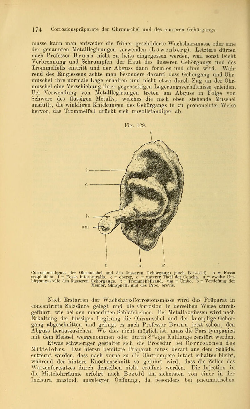 masse kann man entweder die früher geschilderte Wachsharzmasse oder eine der genannten Metalllegirungen verwenden (Löwenberg). Letztere dürfen nach Professor Brunn nicht zu heiss eingegossen werden, weil sonst leicht Verbrennung und Schrumpfen der Haut des äusseren Gehörgangs und des Trommelfells eintritt und der Abguss dann formlos und dünn wird. Wäh- rend des Eingiessens achte man besonders darauf, dass Gehörgang und Ohr- muschel ihre normale Lage erhalten und nicht etwa durch Zug an der Ohr- muschel eine Verschiebung ihrer gegenseitigen Lagerungsverhältnisse erleiden. Bei Verwendung von Metalllegirungen treten am Abguss in Folge von Schwere des flüssigen Metalls, welches die nach oben stehende Muschel ausfüllt, die winkligen Knickungen des Gehörgangs in zu prononcirter Weise hervor, das Trommelfell drückt sich unvollständiger ab. Fig. 129. Corrosionsabguss der Ohrmuschel und des äusseren Gehörgangs (nach Bezold). s = Fossa scaphoidea. i = Fossa intercruralis. c = oberer, c' = unterer Theü der Concha. u - zweite Uin- biegungsstelle des äusseren Gehörgangs, t = Trommelfellrand, um = Umbo. b = Vertiefung der Membr. Shrapnelli und des Proc. brevis. Nach Erstarren der Wachsharz-Corrosionsmasse wird das Präparat in concentrirte Salzsäure gelegt und die Corrosion in derselben Weise durch- geführt, wie bei den macerirten Schläfebeinen. Bei Metallabgüssen wird nach Erkaltung der flüssigen Legirung die Ohrmuschel und der knorplige Gehör- gang abgeschnitten und gelingt es nach Professor Brunn jetzt schon, den Abguss herauszuziehen. Wo dies nicht möglich ist, muss die Pars tympanica mit dem Meissel weggenommen oder durch 8°|oige Kalilauge zerstört werden. Etwas schwieriger gestaltet sich die Procedur bei Corrosionen des Mittelohrs. Das hierzu benützte Präparat muss derart aus dem Schädel entfernt werden, dass nach vorne zu die Ohrtrompete intact erhalten bleibt, während der hintere Knochenschnitt so geführt wird, dass die Zellen des Warzenfortsatzes durch denselben nicht eröffnet werden. Die Injection in die Mittelohrräume erfolgt nach Bezold am sichersten von einer in der Incisura mastoid. angelegten Oeffnung, da besonders bei pneumatischen