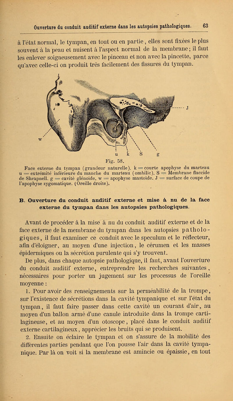 à l'état normal, le tympan, en tout ou en partie, elles sont fixées le plus souvent à la peau et nuisent à l'aspect normal de la membrane; il faut les enlever soigneusement avec le pinceau et non avec la pincette, parce qu'avec celle-ci on produit très facilement des fissures du tympan. Fig. 58. Face externe du tympan (grandeur naturelle). k = courte apophyse du marteau u = extrémité inférieure du manche du marteau (ombilic). S = Membrane flaccide de Shrapnell. g = cavité glénoïde. w = apophyse mastoïde. J = surface de coupe de l'apophyse zygomatique. (Oreille droite). B. Ouverture du conduit auditif externe et mise à nu de la face externe du tympan dans les autopsies pathologiques. Avant de procéder à la mise à nu du conduit auditif externe et de la face externe de la membrane du tympan dans les autopsies patholo- giques, il faut examiner ce conduit avec le spéculum et le réflecteur, afin d'éloigner, au moyen d'une injection, le cérumen et les masses épi dermiques ou la sécrétion purulente qui s'y trouvent. De plus, dans chaque autopsie pathologique, il faut, avant l'ouverture du conduit auditif externe, entreprendre les recherches suivantes , nécessaires pour porter un jugement sur les processus de l'oreille moyenne : 1. Pour avoir des renseignements sur la perméabilité de la trompe, sur l'existence de sécrétions dans la cavité tympanique et sur l'état du tympan, il faut faire passer dans cette cavité un courant d'air, au moyen d'un ballon armé d'une canule introduite dans la trompe carti- lagineuse, et au moyen d'un otoscope, placé dans le conduit auditif externe cartilagineux, apprécier les bruits qui se produisent. 2. Ensuite on éclaire le tympan et on s'assure de la mobilité des différentes parties pendant que l'on pousse l'air dans la cavité tympa- nique. Par là on voit si la membrane est amincie ou épaissie, en tout