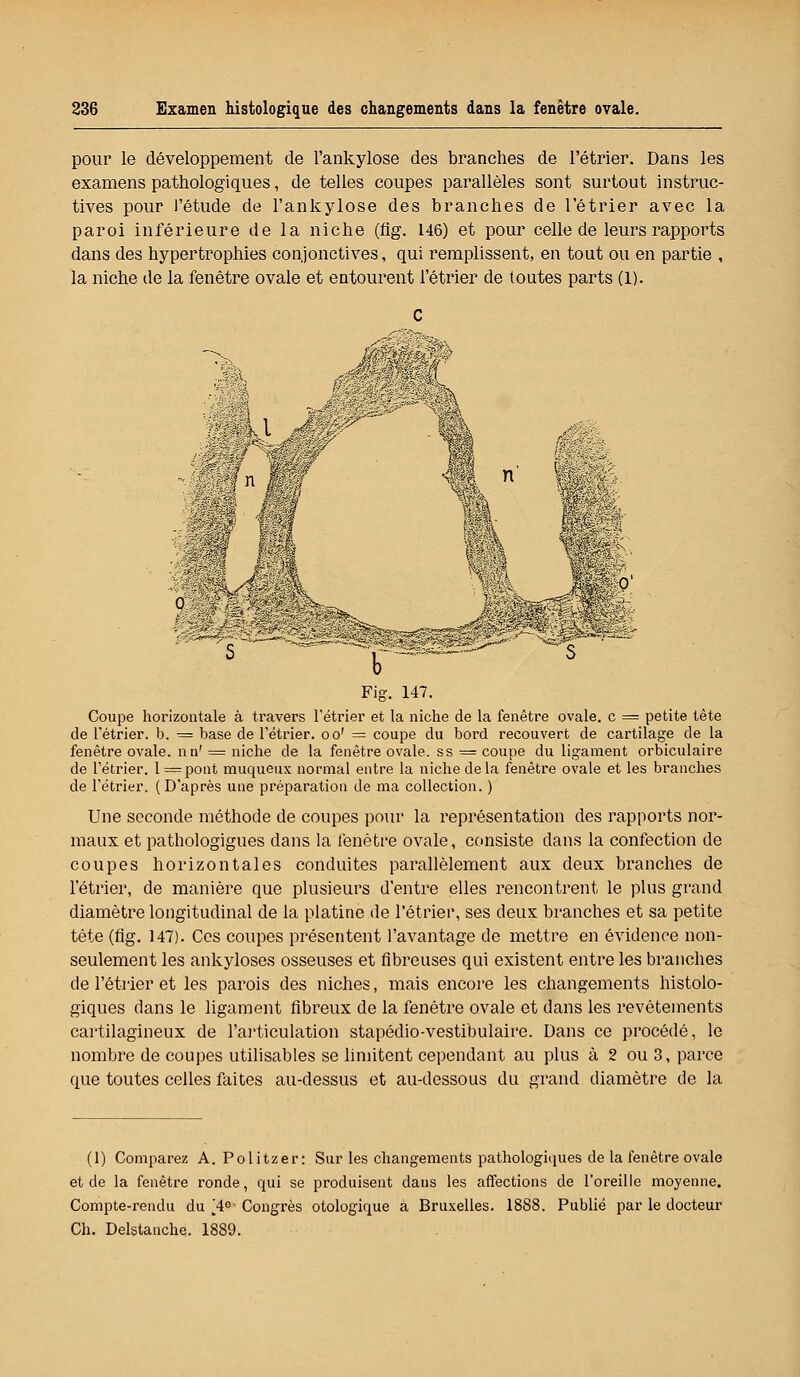 pour le développement de l'ankylose des branches de l'étrier. Dans les examens pathologiques, de telles coupes parallèles sont surtout instruc- tives pour l'étude de l'ankylose des branches de l'étrier avec la paroi inférieure de la niche (fig. 146) et pour celle de leurs rapports dans des hypertrophies conjonctives, qui remplissent, en tout ou en partie , la niche de la fenêtre ovale et entourent l'étrier de toutes parts (1). Fig. 147. Coupe horizontale à travers l'étrier et la niche de la fenêtre ovale, c = petite tète de l'étrier. b. = base de l'étrier. oo' = coupe du bord recouvert de cartilage de la fenêtre ovale. nn' = niche de la fenêtre ovale, ss = coupe du ligament orbiculaire de l'étrier. l = pont muqueux normal entre la niche delà fenêtre ovale et les branches de l'étrier. ( D'après une préparation de ma collection. ) Une seconde méthode de coupes pour la représentation des rapports nor- maux et pathologigues dans la fenêtre ovale, consiste dans la confection de coupes horizontales conduites parallèlement aux deux branches de l'étrier, de manière que plusieurs d'entre elles rencontrent le plus grand diamètre longitudinal de la platine de l'étrier, ses deux branches et sa petite tète (flg. 147). Ces coupes présentent l'avantage de mettre en évidence non- seulement les ankyloses osseuses et fibreuses qui existent entre les branches de l'étrier et les parois des niches, mais encore les changements histolo- giques dans le ligament fibreux de la fenêtre ovale et dans les revêtements cartilagineux de l'articulation stapédio-vestibulaire. Dans ce procédé, le nombre de coupes utilisables se limitent cependant au plus à 2 ou 3, parce que toutes celles faites au-dessus et au-dessous du grand diamètre de la (1) Comparez A. Politzer: Sur les changements pathologiques de la fenêtre ovale et de la fenêtre ronde, qui se produisent dans les affections de l'oreille moyenne. Compte-rendu du [4e- Congrès otologique à Bruxelles. 18S8. Publié par le docteur Ch. Delstanche. 1889.