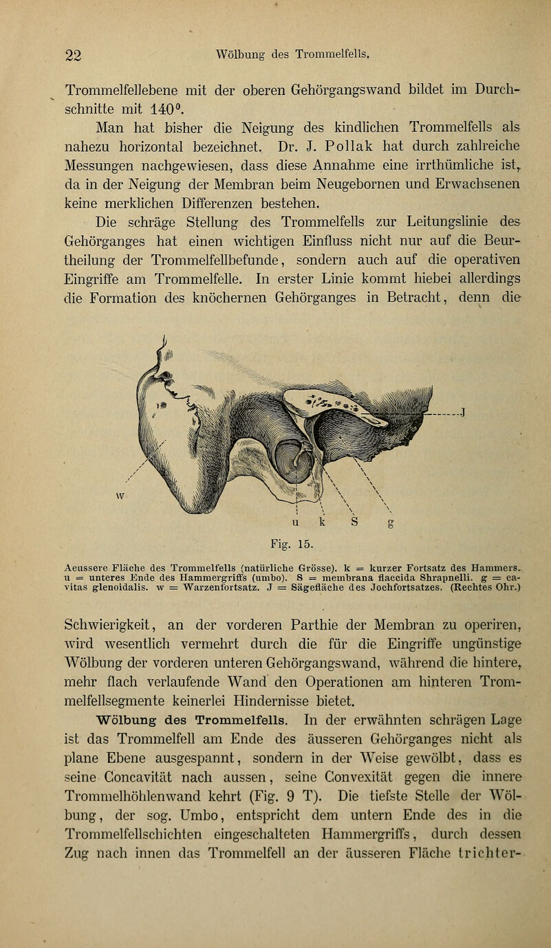 Trommelfellebene mit der oberen Gehörgangswand bildet im Durch- schnitte mit 140°. Man hat bisher die Neigung des kindlichen Trommelfells als nahezu horizontal bezeichnet. Dr. J. Pollak hat durch zahlreiche Messungen nachgewiesen, dass diese Annahme eine irrthümliche ist,, da in der Neigung der Membran beim Neugebornen und Erwachsenen keine merklichen Differenzen bestehen. Die schräge Stellung des Trommelfells zur Leitungslinie des Gehörganges hat einen wichtigen Einfluss nicht nur auf die Beur- theilung der Trommelfellbefunde, sondern auch auf die operativen Eingriffe am Trommelfelle. In erster Linie kommt hiebei allerdings die Formation des knöchernen Gehörganges in Betracht, denn die 5p\ \ u k S g Fig. 15. Aeussere Fläche des Trommelfells (natürliche Grösse), k = kurzer Fortsatz des Hammers, u = unteres Ende des Hammergriffs (umbo). S = membrana flaccida Shrapnelli. g = ca- vitas glenoidalis. w = Warzenfortsatz. J = Sägefläche des Jochfortsatzes. (Rechtes Ohr.) Schwierigkeit, an der vorderen Parthie der Membran zu operiren, wird wesentlich vermehrt durch die für die Eingriffe ungünstige Wölbung der vorderen unteren Gehörgangswand, während die hintere, mehr flach verlaufende Wand den Operationen am hinteren Trom- melfellsegmente keinerlei Hindernisse bietet. Wölbung des Trommelfells. In der erwähnten schrägen Lage ist das Trommelfell am Ende des äusseren Gehörganges nicht als plane Ebene ausgespannt, sondern in der Weise gewölbt, dass es seine Goncavität nach aussen, seine Convexität gegen die innere Trommelhöhlenwand kehrt (Fig. 9 T). Die tiefste Stelle der Wöl- bung, der sog. Umbo, entspricht dem untern Ende des in die Trommelfellschichten eingeschalteten Hammergriffs, durch dessen Zug nach innen das Trommelfell an der äusseren Fläche trichter-