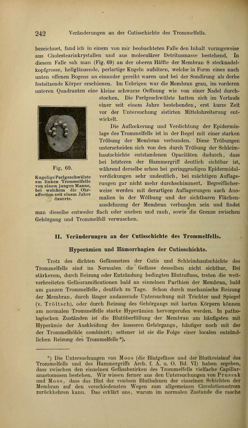 bezeichnet, fand ich in einem von mir beobachteten Falle den Inhalt vorzugsweise aus Cholestearinkrystallen und aus moleculärer Detritusmasse bestehend. In diesem Falle sah man (Fig. 69) an der oberen Hälfte der Membran 8 stecknadel- kopfgrosse, hellglänzende, perlartige Kugeln aufsitzen, welche in Form eines nach unten offenen Bogens an einander gereiht waren und bei der Sondirung als derbe festsitzende Körper erschienen. Im Uebrigen war die Membran grau, im vorderen unteren Quadranten eine kleine schwarze Oeffnung wie von einer Nadel durch- stochen. Die Perlgeschwülste hatten sich im Verlaufe einer seit einem Jahre bestehenden, erst kurze Zeit vor der Untersuchung sistirten Mittelohreiterung ent- wickelt. Die Auflockerung und Verdichtung der Epidermis- lage des Trommelfells ist in der Regel mit einer starken Trübung der Membran verbunden. Diese Trübungen unterscheiden sich von den durch Trübung der Schleim- hautschichte entstandenen Opacitäten dadurch, dass bei letzteren der Hammergriff deutlich sichtbar ist, Fig. 69. während derselbe schon bei geringgradigen Epidermidal- KugeligePerlgeschwülste verdickungen sehr undeutlich, bei mächtigen Auflage- am linken Trommelfelle rungen gar nicht mehr durchschimmert. Begreiflicher- von einem jungen Manne, s s ^ • s bei welchem die Ohr- weise werden mit derartigen Auflagerungen auch Ano- affection seit einem Jahre ,. . , TIT..„i -in in ™» i dauerte. mähen in der Wölbung und der sichtbaren Flachen- ausdehnung der Membran verbunden sein und findet man dieselbe entweder flach oder uneben und rauh, sowie die Grenze zwischen Gehörgang und Trommelfell verwaschen. II. Veränderungen an der Cutisschichte des Trommelfells. Hyperämien und Hämorrhagien der Cutisschichte. Trotz des dichten Gefässnetzes der Cutis und Schleimhautschichte des Trommelfells sind im Normalen die Gefässe desselben nicht sichtbar. Bei stärkerem, durch Reizung oder Entzündung bedingten Blutzufluss, treten die weit- verbreiteten Gefässramificationen bald an einzelnen Parthien der Membran, bald am ganzen Trommelfelle, deutlich zu Tage. Schon durch mechanische Reizung der Membran, durch länger andauernde Untersuchung mit Trichter und Spiegel (v. Tröltsch), oder durch Reizung des Gehörgangs mit harten Körpern können am normalen Trommelfelle starke Hyperämien hervorgerufen werden. In patho- logischen Zuständen ist die Blutüberfüllung der Membran am häufigsten mit Hyperämie der Auskleidung des äusseren Gehörgangs, häufiger noch mit der der Trommelhöhle combinirt; seltener ist sie die Folge einer localen entzünd- lichen Reizung des Trommelfells *). *) Die Untersuchungen von Moos (die Blutgefässe und der Blutkreislauf des Trommelfells und des Hammergriffs Arch. f. A. u. 0. Bd. VI) haben ergeben, dass zwischen den einzelnen Gefässbezirken des Trommelfells vielfache Capillar- anastomosen bestehen. Wir wissen ferner aus den Untersuchungen von Prussak und Moos, dass das Blut der venösen Blutbahnen der einzelnen Schichten der Membran auf den verschiedensten Wegen zum allgemeinen Chruhitionsstrom zurückkehren kann. Das erklärt uns, warum im normalen Zustande die rasche