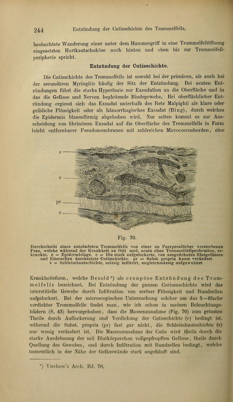 beobachtete Wanderung einer unter dem Hammergriff in eine Trommelfellöffnung eingesetzten Hartkautschuköse nach hinten und oben bis zur Trommelfell- peripherie spricht. Entzündung der Cutisschichte. Die Cutisschichte des Trommelfells ist sowohl bei der primären, als auch bei der secundären Myringitis häufig der Sitz der Entzündung. Bei acuten Ent- zündungen führt die starke Hyperämie zur Exsudation an die Oberfläche und in das die Gefässe und Nerven begleitende Bindegewebe. Bei oberflächlicher Ent- zündung ergiesst sich das Exsudat unterhalb des Bete Malpighii als klare oder gelbliche Flüssigkeit oder als hämorrhagisches Exsudat (Bing), durch welches die Epidermis blasenförmig abgehoben wird. Nur selten kommt es zur Aus- scheidung von fibrinösem Exsudat auf die Oberfläche des Trommelfells in Form leicht entfernbarer Pseudomembranen mit zahlreichen Micrococcusherden, eine Fig. 70. Durchschnitt eines entzündeten Trommelfells von einer an Puerperalfieber verstorbenen Frau, welche während der Krankheit an Otit med. acuta ohne Trommelfellperforation, er- krankte, e = Epidermislage. c = Die stark aufgelockerte, von ausgedehnten Blutgefässen und Eiterzellen durchsetzte Cutisschichte. pr = Subst. propria kaum verändert. s = Schleimhautschichte, massig infiltrirt, ungleichmässig aufgewulstet. Krankheitsform, welche Bezold*) als croupöse Entzündung des Trom- melfells bezeichnet. Bei Entzündung der ganzen Goriumschichte wird das interstitielle Gewebe durch Infiltration von seröser Flüssigkeit und Bundzellen aufgelockert. Bei der microscopischen Untersuchung solcher um das 5—6fache verdickter Trommelfelle findet man, wie ich schon in meinen Beleuchtungs- bildern (S. 43) hervorgehoben, dass die Massenzunahme (Fig. 70) zum grösstetl Theile durch Auflockerung und Verdickung der Cutisschichte (c) bedingt ist, während die Subst. propria (pr) fast gar nicht, die Schleimhautschichte (s) nur wenig verändert ist. Die Massenzunahme der Cutis wird theils durch die starke Ausdehnung der mit Blutkörperchen vollgepfropften Gefässe, theils durch Quellung des Gewebes, und durch Infiltration mit Bundzellen hedingt, welche namentlich in der Nähe der Gefässwilnde stark angehäuft sind. y) Vircbow's Arch. Bd. 70.