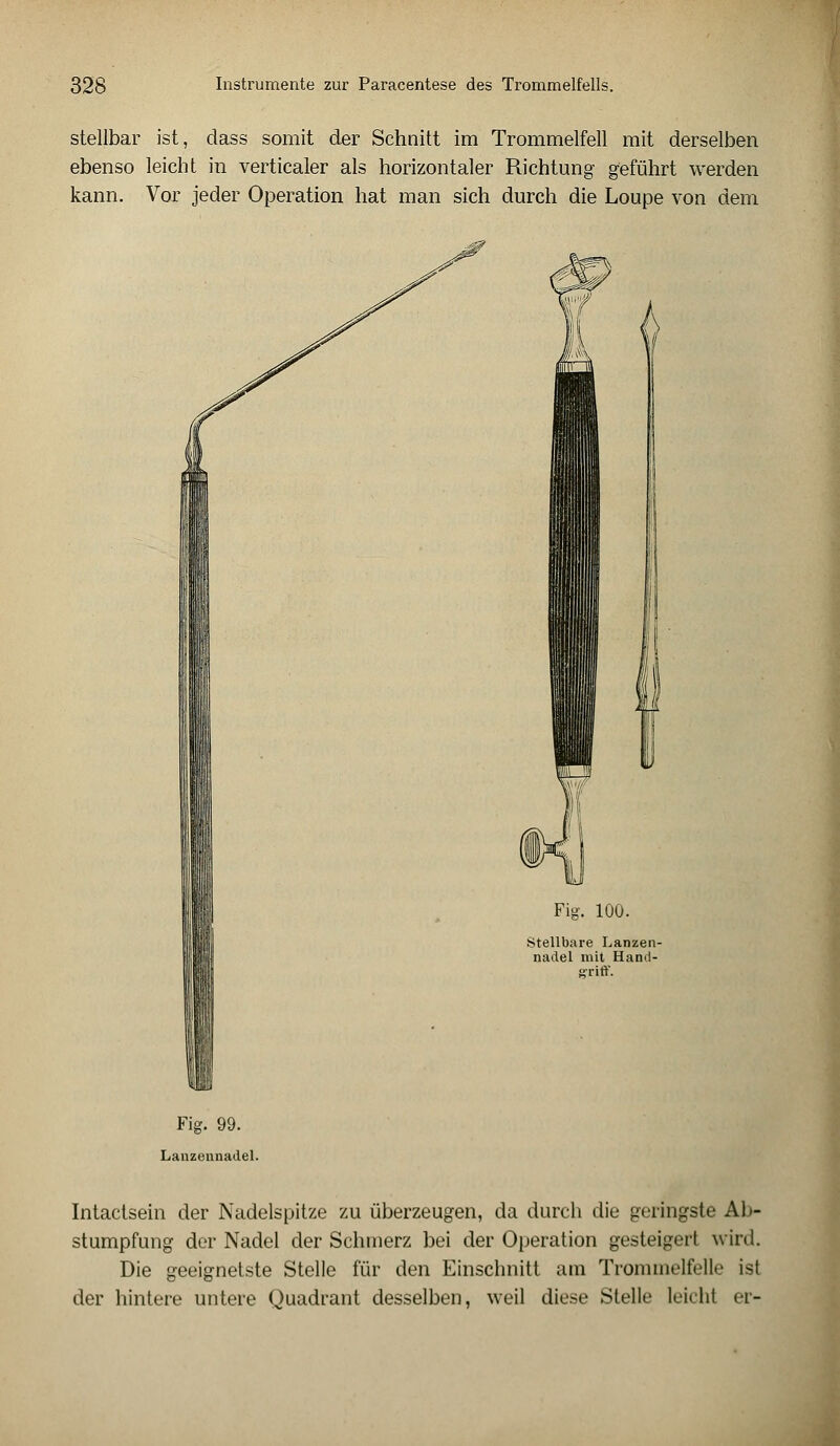 stellbar ist, dass somit der Schnitt im Trommelfell mit derselben ebenso leicht in verticaler als horizontaler Richtung geführt werden kann. Vor jeder Operation hat man sich durch die Loupe von dem Fig. 100. Stellbare Lanzen- nadel mit Hand- griff. Fig. 99. Lanzennadel. Intactsein der Nadelspitze zu überzeugen, da durch die geringste Ab- stumpfung der Nadel der Schmerz bei der Operation gesteigert wird. Die geeignetste Stelle für den Einschnitt am Trommelfelle ist der hintere untere Quadrant desselben, weil diese Stelle leicht er-