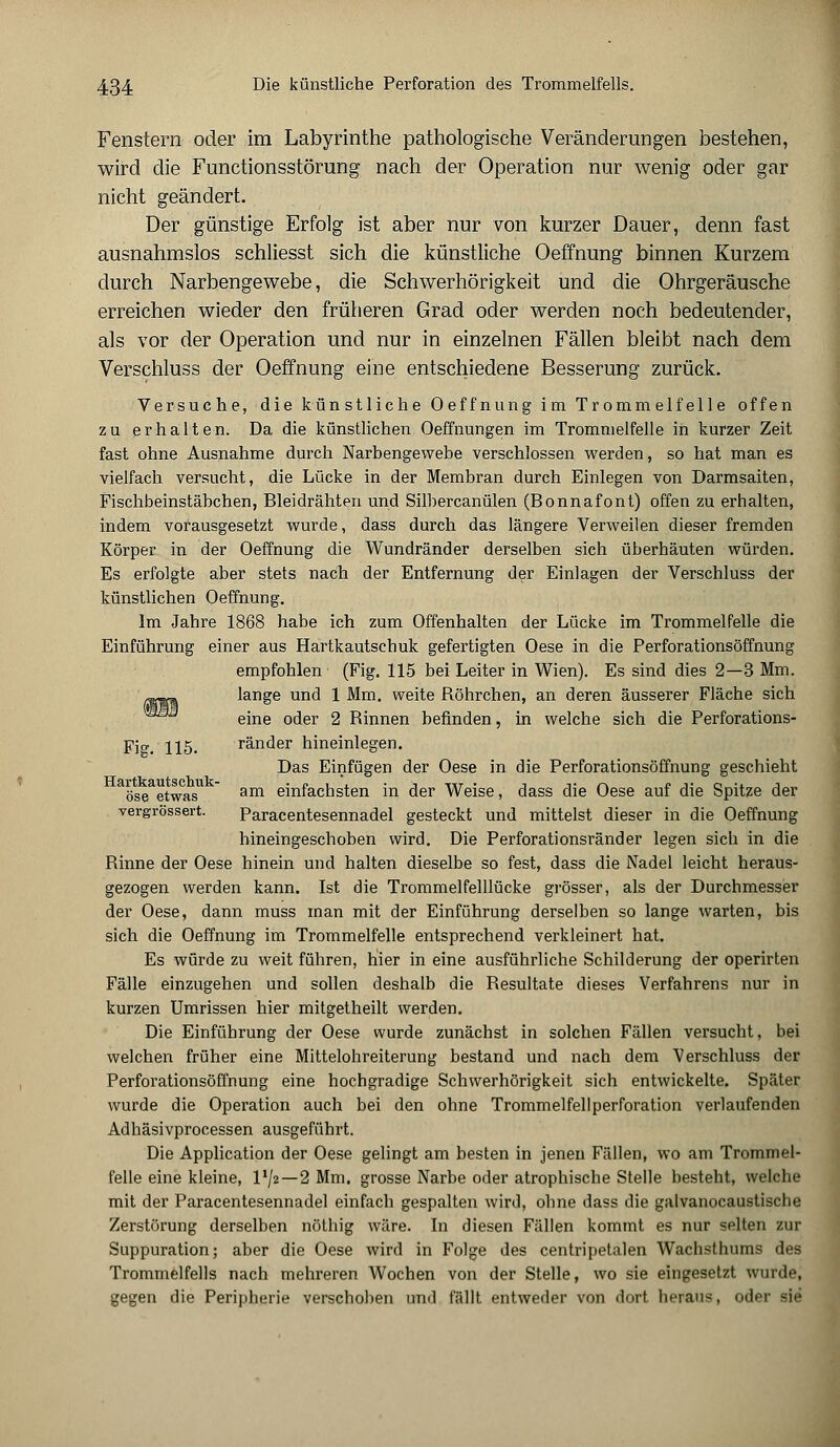 Fenstern oder im Labyrinthe pathologische Veränderungen bestehen, wird die Functionsstörung nach der Operation nur wenig oder gar nicht geändert. Der günstige Erfolg ist aber nur von kurzer Dauer, denn fast ausnahmslos schliesst sich die künstliche Oeffnung binnen Kurzem durch Narbengewebe, die Schwerhörigkeit und die Ohrgeräusche erreichen wieder den früheren Grad oder werden noch bedeutender, als vor der Operation und nur in einzelnen Fällen bleibt nach dem Verschluss der Oeffnung eine entschiedene Besserung zurück. Versuche, die künstliche Oeffnung im Trommelfelle offen zu erhalten. Da die künstlichen Oeffnungen im Trommelfelle in kurzer Zeit fast ohne Ausnahme durch Narbengewebe verschlossen werden, so hat man es vielfach versucht, die Lücke in der Membran durch Einlegen von Darmsaiten, Fischbeinstäbchen, Bleidrähten und Silbercanülen (Bonnafont) offen zu erhalten, indem vorausgesetzt wurde, dass durch das längere Verweilen dieser fremden Körper in der Oeffnung die Wundränder derselben sich überhäuten würden. Es erfolgte aber stets nach der Entfernung der Einlagen der Verschluss der künstlichen Oeffnung. Im Jahre 1868 habe ich zum Offenhalten der Lücke im Trommelfelle die Einführung einer aus Hartkautschuk gefertigten Oese in die Perforationsöffnung empfohlen (Fig. 115 bei Leiter in Wien). Es sind dies 2—3 Mm. lange und 1 Mm. weite Röhrchen, an deren äusserer Fläche sich eine oder 2 Rinnen befinden, in welche sich die Perforations- Fic. 115. ränder hineinlegen. Das Einfügen der Oese in die Perforationsöffnung geschieht ose etwas1  am einfachsten in der Weise, dass die Oese auf die Spitze der vergrössert. Paracentesennadel gesteckt und mittelst dieser in die Oeffnung hineingeschoben wird. Die Perforationsränder legen sich in die Rinne der Oese hinein und halten dieselbe so fest, dass die Nadel leicht heraus- gezogen werden kann. Ist die Trommelfelllücke grösser, als der Durchmesser der Oese, dann muss man mit der Einführung derselben so lange warten, bis sich die Oeffnung im Trommelfelle entsprechend verkleinert hat. Es würde zu weit führen, hier in eine ausführliche Schilderung der operirten Fälle einzugehen und sollen deshalb die Resultate dieses Verfahrens nur in kurzen Umrissen hier mitgetheilt werden. Die Einführung der Oese wurde zunächst in solchen Fällen versucht, bei welchen früher eine Mittelohreiterung bestand und nach dem Verschluss der Perforationsöffnung eine hochgradige Schwerhörigkeit sich entwickelte. Später wurde die Operation auch bei den ohne Trommelfellperforation verlaufenden Adhäsivprocessen ausgeführt. Die Application der Oese gelingt am besten in jenen Fällen, wo am Trommel- felle eine kleine, VJ2 — 2 Mm. grosse Narbe oder atrophische Stelle besteht, welche mit der Paracentesennadel einfach gespalten wird, ohne dass die galvanocaustische Zerstörung derselben nöthig wäre. In diesen Fällen kommt es nur selten zur Suppuration; aber die Oese wird in Folge des centripetalen Wachsthums des Trommelfells nach mehreren Wochen von der Stelle, wo sie eingesetzt wurde, gegen die Peripherie verschoben und fällt entweder von dort heraus, oder sie
