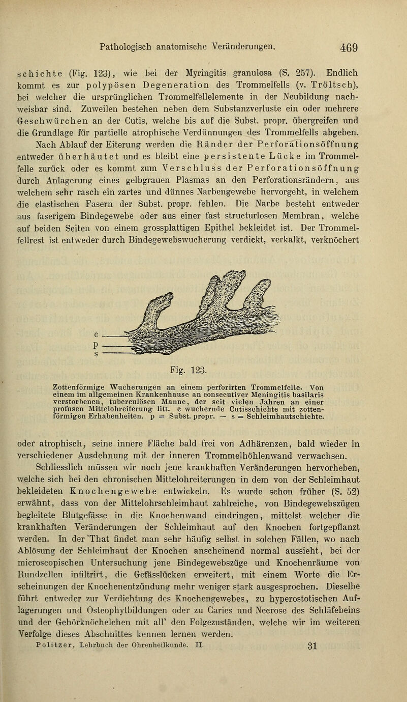 schichte (Fig. 123), wie bei der Myringitis granulosa (S. 257). Endlich kommt es zur polypösen Degeneration des Trommelfells (v. Tröltsch), bei welcher die ursprünglichen Trommelfellelemente in der Neubildung nach- weisbar sind. Zuweilen bestehen neben dem Substanzverluste ein oder mehrere Geschwürchen an der Cutis, welche bis auf die Subst. propr. übergreifen und die Grundlage für partielle atrophische Verdünnungen des Trommelfells abgeben. Nach Ablauf der Eiterung werden die Ränder der Perforationsöffnung entweder überhäutet und es bleibt eine persistente Lücke im Trommel- felle zurück oder es kommt zum Verschluss der Perforationsöffnung durch Anlagerung eines gelbgrauen Plasmas an den Perforationsrändern, aus welchem sehr rasch ein zartes und dünnes Narbengewebe hervorgeht, in welchem die elastischen Fasern der Subst. propr. fehlen. Die Narbe besteht entweder aus faserigem Bindegewebe oder aus einer fast structurlosen Membran, welche auf beiden Seiten von einem grossplattigen Epithel bekleidet ist. Der Trommel- fellrest ist entweder durch Bindegewebswucherung verdickt, verkalkt, verknöchert Fig. 123. Zottenförmige Wucherungen an einem perforirten Trommelfelle. Von einem im allgemeinen Krankenhause an consecutiver Meningitis basilaris verstorbenen, tuberculösen Manne, der seit vielen Jahren an einer profusen Mittelohreiterung litt, c wuchernde Cutisschichte mit zotten- förmigen Erhabenheiten, p = Subst. propr. — s = Schleimhautsehichte. oder atrophisch, seine innere Fläche bald frei von Adhärenzen, bald wieder in verschiedener Ausdehnung mit der inneren Trommelhöhlenwand verwachsen. Schliesslich müssen wir noch jene krankhaften Veränderungen hervorheben, welche sich bei den chronischen Mittelohreiterungen in dem von der Schleimhaut bekleideten Knochengewebe entwickeln. Es wurde schon früher (S. 52) erwähnt, dass von der Mittelohrschleimhaut zahlreiche, von Bindegewebszügen begleitete Blutgefässe in die Knochenwand eindringen, mittelst welcher die krankhaften Veränderungen der Schleimhaut auf den Knochen fortgepflanzt werden. In der That findet man sehr häufig selbst in solchen Fällen, wo nach Ablösung der Schleimbaut der Knochen anscheinend normal aussieht, bei der microscopischen Untersuchung jene Bindegewebszüge und Knochenräume von Rundzellen infiltrirt, die Gefässlücken erweitert, mit einem Worte die Er- scheinungen der Knochenentzündung mehr weniger stark ausgesprochen. Dieselbe führt entweder zur Verdichtung des Knochengewebes, zu hyperostotischen Auf- lagerungen und Osteophytbildungen oder zu Caries und Necrose des Schläfebeins und der Gehörknöchelchen mit all1 den Folgezuständen, welche wir im weiteren Verfolge dieses Abschnittes kennen lernen werden. Politzer, Lehrbuch der Ohrenheilkunde. II. 31