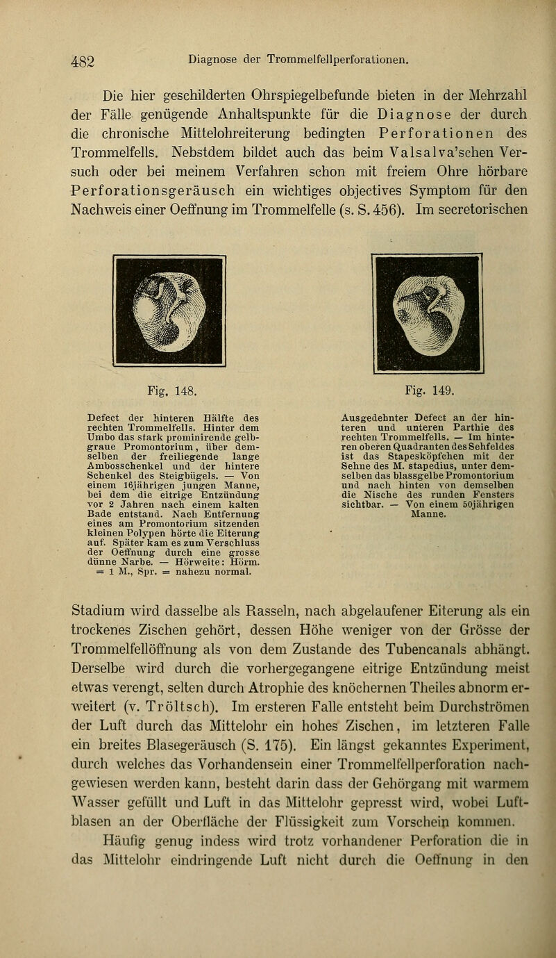 Die hier geschilderten Ohrspiegelbefunde bieten in der Mehrzahl der Fälle genügende Anhaltspunkte für die Diagnose der durch die chronische Mittelohreiterung bedingten Perforationen des Trommelfells. Nebstdem bildet auch das beim Valsalva'schen Ver- such oder bei meinem Verfahren schon mit freiem Ohre hörbare Perforationsgeräusch ein wichtiges objectives Symptom für den Nachweis einer Oeffnung im Trommelfelle (s. S. 456). Im secretorischen Fig. 148. Defect der hinteren Hälfte des rechten Trommelfells. Hinter dem Umbo das stark prominirende gelb- graue Promontorium, über dem- selben der freiliegende lange Ambosschenkel und der hintere Schenkel des Steigbügels. — Von einem 16jährigen jungen Manne, bei dem die eitrige Entzündung vor 2 Jahren nach einem kalten Bade entstand. Nach Entfernung eines am Promontorium sitzenden kleinen Polypen hörte die Eiterung auf. Später kam es zum Verschluss der Oeffnung durch eine grosse dünne Narbe. — Hörweite: Hörm. = 1 M., Spr. = nahezu normal. Fig. 149. Ausgedehnter Defect an der hin- teren und unteren Parthie des rechten Trommelfells. — Im hinte- ren oberen Quadranten des Sehfeldes ist das Stapesköpfchen mit der Sehne des M. stapedius, unter dem- selben das blassgelbe Promontorium und nach hinten von demselben die Nische des runden Fensters sichtbar. — Von einem 50jährigen Manne. Stadium wird dasselbe als Rasseln, nach abgelaufener Eiterung als ein trockenes Zischen gehört, dessen Höhe weniger von der Grösse der Trommelfellöffnung als von dem Zustande des Tubencanals abhängt. Derselbe wird durch die vorhergegangene eitrige Entzündung meist etwas verengt, selten durch Atrophie des knöchernen Theiles abnorm er- weitert (v. Tröltsch). Im ersteren Falle entsteht beim Durchströmen der Luft durch das Mittelohr ein hohes Zischen, im letzteren Falle ein breites Blasegeräusch (S. 175). Ein längst gekanntes Experiment, durch welches das Vorhandensein einer Trommelfellperforation nach- gewiesen werden kann, besteht darin dass der Gehörgang mit warmem Wasser gefüllt und Luft in das Mittelohr gepresst wird, wobei Luft- blasen an der Oberfläche der Flüssigkeit zum Vorschein kommen. Häufig genug indess wird trotz vorhandener Perforation die in das Mittelohr eindringende Luft nicht durch die Oeffnung in den