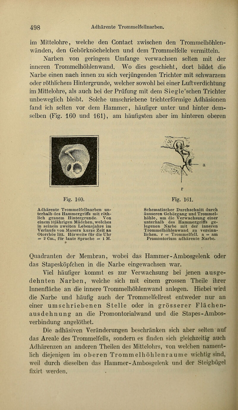 im Mittelohre, welche den Contact zwischen den Trommelhöhlen- wänden, den Gehörknöchelchen und dem Trommelfelle vermitteln. Narben von geringem Umfange verwachsen selten mit der inneren Trommelhöhlenwand. Wo dies geschieht, dort bildet die Narbe einen nach innen zu sich verjüngenden Trichter mit schwarzem oder röthlichem Hintergrunde, welcher sowohl bei einer Luftverdichtung im Mittelohre, als auch bei der Prüfung mit dem Siegle'schen Trichter unbeweglich bleibt. Solche umschriebene trichterförmige Adhäsionen fand ich selten vor dem Hammer, häufiger unter und hinter dem- selben (Fig. 160 und 161), am häufigsten aber im hinteren oberen Fig. 160. Adhärente Trommelfellnarben un- terhalb des Hammergriffs mit röth- lich grauem Hintergrunde. Von einem 10jährigen Mädchen, welches in seinem zweiten Lebensjahre im Verlaufe von Masern kurze Zeit an Otorrhöe litt. Hörweite für die Uhr = 2 Cm., für laute Sprache = 1 M. Fig. 161. Schematischer Durchschnitt durch äusseren Gehörgang und Trommel- höhle, um die Verwachsung einer unterhalb des Hammergriffs ge- legenen Narbe mit der inneren Trommelhöhlenwand zu versinn- lichen, r = Trommelfell, a = am Promontorium adhärente Narbe. Quadranten der Membran, wobei das Hammer-Ambosgelenk oder das Stapesköpfchen in die Narbe eingewachsen war. Viel häufiger kommt es zur Verwachsung bei jenen ausge- dehnten Narben, welche sich mit einem grossen Theile ihrer Innenfläche an die innere Trommelhöhlenwand anlegen. Hiebei wird die Narbe und häufig auch der Trommelfellrest entweder nur an einer umschriebenen Stelle oder in grösserer Flächen- ausdehnung an die Promontorialwand und die Stapes-Ambos- verbindung angelöthet. Die adhäsiven Veränderungen beschränken sich aber selten auf das Areale des Trommelfells, sondern es finden sich gleichzeitig auch Adhärenzen an anderen Theilen des Mittelohrs, von welchen nament- lich diejenigen im oberen Trommelhöhlenraume wichtig sind, weil durch dieselben das Hammer-Ambosgelenk und der Steigbügel fixirt werden.