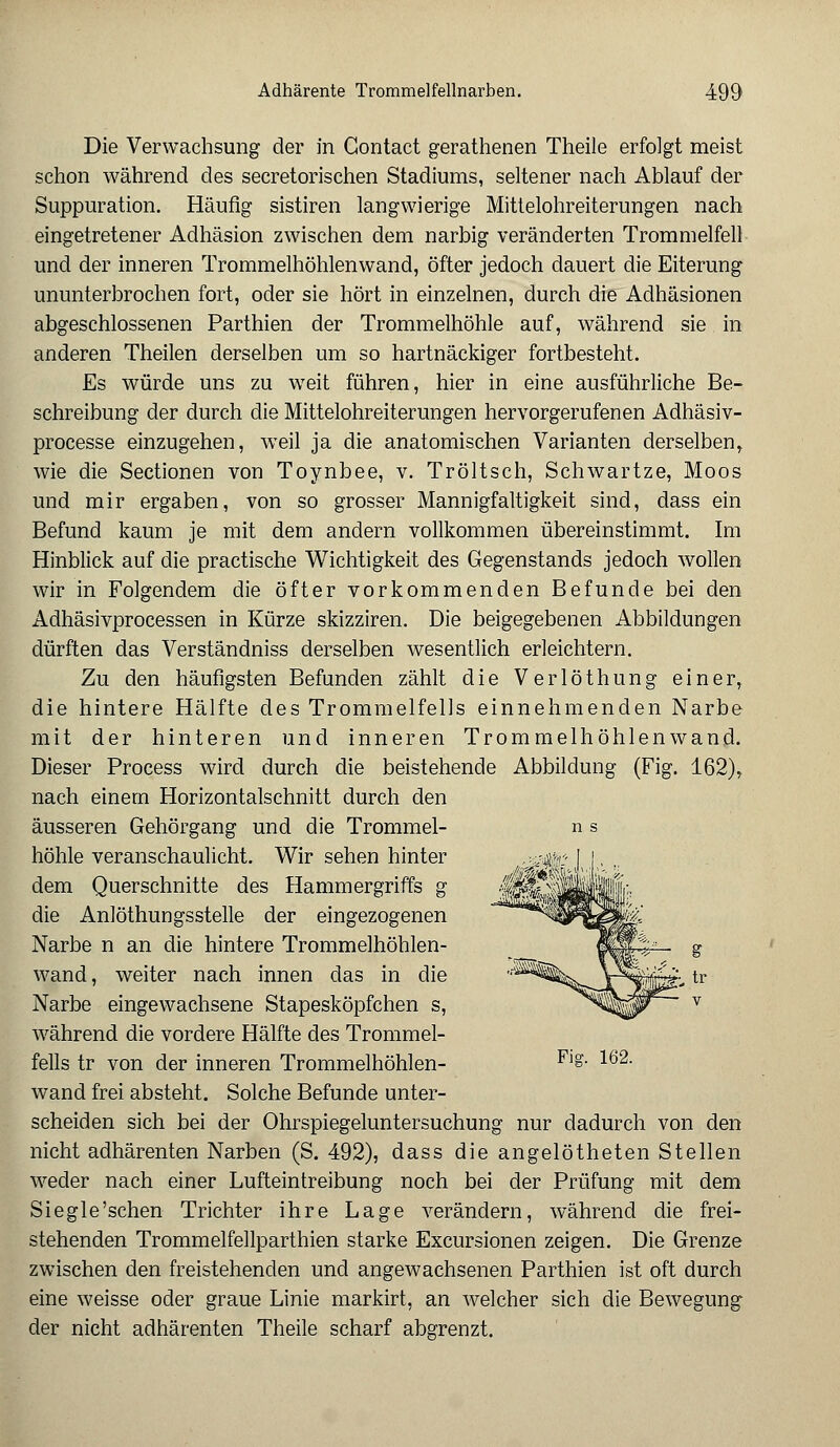 Die Verwachsung der in Gontact gerathenen Theile erfolgt meist schon während des secretorischen Stadiums, seltener nach Ablauf der Suppuration. Häufig sistiren langwierige Mittelohreiterungen nach eingetretener Adhäsion zwischen dem narbig veränderten Trommelfell und der inneren Trommelhöhlenwand, öfter jedoch dauert die Eiterung ununterbrochen fort, oder sie hört in einzelnen, durch die Adhäsionen abgeschlossenen Parthien der Trommelhöhle auf, während sie in anderen Theilen derselben um so hartnäckiger fortbesteht. Es würde uns zu weit führen, hier in eine ausführliche Be- schreibung der durch die Mittelohreiterungen hervorgerufenen Adhäsiv- processe einzugehen, weil ja die anatomischen Varianten derselben, wie die Sectionen von Toynbee, v. Tröltsch, Schwartze, Moos und mir ergaben, von so grosser Mannigfaltigkeit sind, dass ein Befund kaum je mit dem andern vollkommen übereinstimmt. Im Hinblick auf die practische Wichtigkeit des Gegenstands jedoch wollen wir in Folgendem die öfter vorkommenden Befunde bei den Adhäsivprocessen in Kürze skizziren. Die beigegebenen Abbildungen dürften das Verständniss derselben wesentlich erleichtern. Zu den häufigsten Befunden zählt die Verlöthung einer, die hintere Hälfte des Trommelfells einnehmenden Narbe mit der hinteren und inneren Trommelhöhlenwanfl. Dieser Process wird durch die beistehende Abbildung (Fig. 162), nach einem Horizontalschnitt durch den äusseren Gehörgang und die Trommel- n s höhle veranschaulicht. Wir sehen hinter dem Querschnitte des Hammergriffs g die Anlöthungsstelle der eingezogenen Narbe n an die hintere Trommelhöhlen- wand, weiter nach innen das in die Narbe eingewachsene Stapesköpfchen s, während die vordere Hälfte des Trommel- fells tr von der inneren Trommelhöhlen- Fl£- lö2- wand frei absteht. Solche Befunde unter- scheiden sich bei der Ohrspiegeluntersuchung nur dadurch von den nicht adhärenten Narben (S. 492), dass die angelötheten Stellen weder nach einer Lufteintreibung noch bei der Prüfung mit dem Siegle'sehen Trichter ihre Lage verändern, während die frei- stehenden Trommelfellparthien starke Exemtionen zeigen. Die Grenze zwischen den freistehenden und angewachsenen Parthien ist oft durch eine weisse oder graue Linie markirt, an welcher sich die Bewegung der nicht adhärenten Theile scharf abgrenzt.