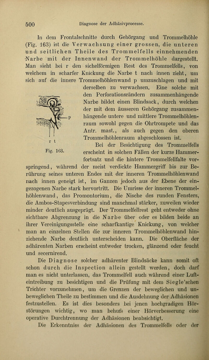 In dem Frontalschnitte durch Gehörgang und Trommelhöhle (Fig. 163) ist die Verwachsung einer grossen, die unteren und seitlichen Theile des Trommelfells einnehmenden -Narbe mit der Innenwand der Trommelhöhle dargestellt. Man sieht bei r den sichelförmigen Rest des Trommelfells, von welchem in scharfer Knickung die Narbe t nach innen zieht, um sich auf die innere Trommelhöhlenwand p umzuschlagen und mit derselben zu verwachsen. Eine solche mit den Perforationsrändern zusammenhängende Narbe bildet einen Blindsack, durch welchen der mit dem äusseren Gehörgang zusammen- hängende untere und mittlere Trommelhöhlen- raum sowohl gegen die Ohrtrompete und das Antr. mast., als auch gegen den oberen Trornmelhöhlenraum abgeschlossen ist. r t Bei der Besichtigung des Trommelfells Fig. 163. erscheint in solchen Fällen der kurze Hammer- fortsatz und die hintere Trommelfellfalte vor- springend, während der meist verdickte Hammergriff bis zur Be- rührung seines unteren Endes mit der inneren Trommelhöhlenwand nach innen geneigt ist, im Ganzen jedoch aus der Ebene der ein- gezogenen Narbe stark hervortritt. Die Umrisse der inneren Trommel- höhlenwand, das Promontorium, die Nische des runden Fensters, die Ambos-Stapesverbindung sind manchmal stärker, zuweilen wieder minder deutlich ausgeprägt. Der Trommelfellrest geht entweder ohne sichtbare Abgrenzung in die Narbe über oder es bilden beide an ihrer Vereinigungsstelle eine scharfkantige Knickung, von welcher man an einzelnen Stellen die zur inneren Trommelhöhlenwand hin- ziehende Narbe deutlich unterscheiden kann. Die Oberfläche der adhärenten Narben erscheint entweder trocken, glänzend oder feucht und secernirend. Die Diagnose solcher adhärenter Blindsäcke kann somit oft schon durch die Inspection allein gestellt werden, doch darf man es nicht unterlassen, das Trommelfell auch während einer Luft- eintreibung zu besichtigen und die Prüfung mit dem Siegle'schen Trichter vorzunehmen, um die Grenzen der beweglichen und un- beweglichen Theile zu bestimmen und die Ausdehnung der Adhäsionen festzustellen. Es ist dies besonders bei jenen hochgradigen Hör- störungen wichtig, wo man behufs einer Hörverbesserung eine operative Durchtrennung der Adhäsionen beabsichtigt. Die Erkenntniss der Adhäsionen des Trommelfells oder der