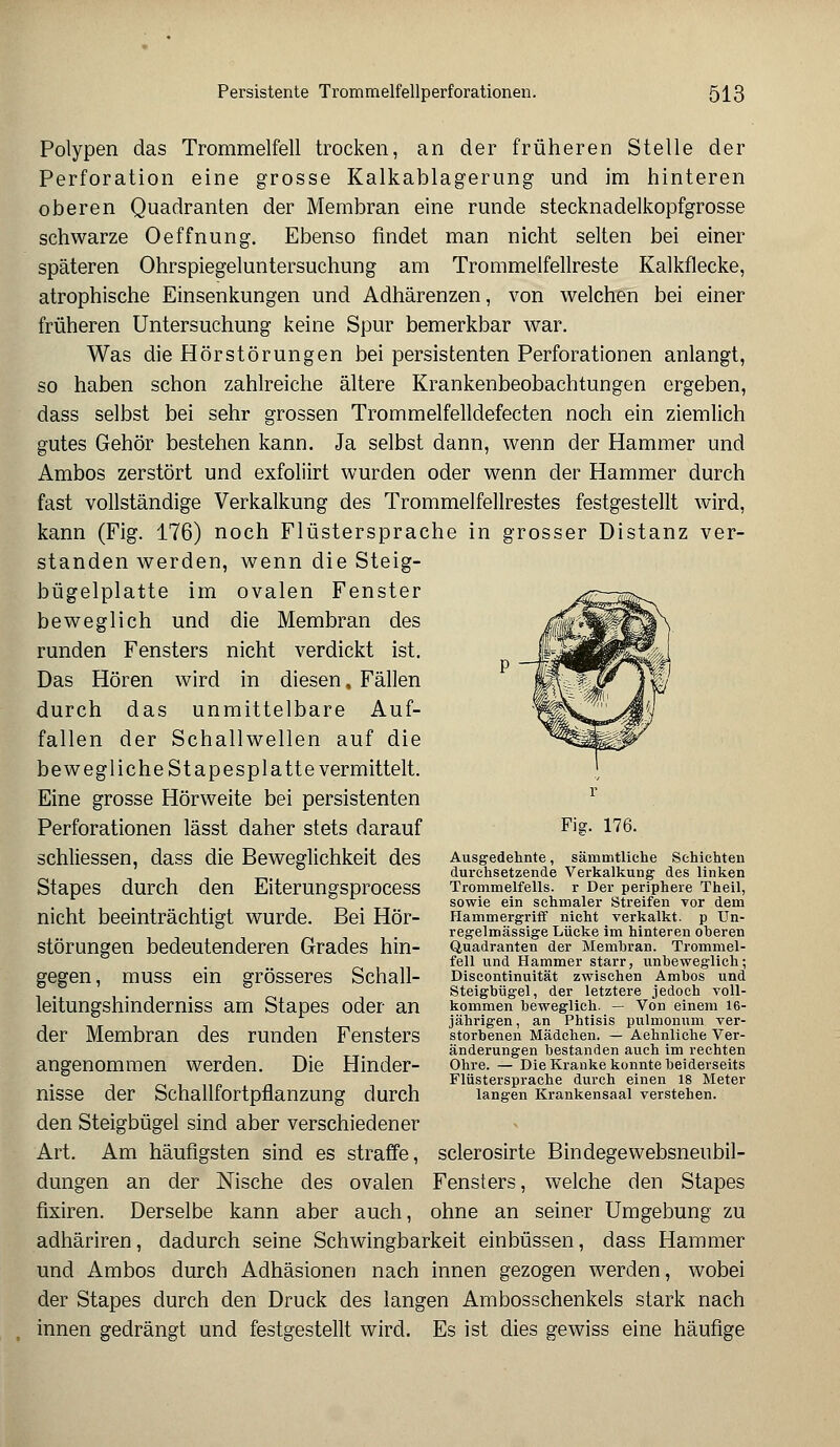 Polypen das Trommelfell trocken, an der früheren Stelle der Perforation eine grosse Kalkablagerung und im hinteren oberen Quadranten der Membran eine runde stecknadelkopfgrosse schwarze Oeffnung. Ebenso findet man nicht selten bei einer späteren Ohrspiegeluntersuchung am Trommelfellreste Kalkflecke, atrophische Einsenkungen und Adhärenzen, von welchen bei einer früheren Untersuchung keine Spur bemerkbar war. Was die Hör Störungen bei persistenten Perforationen anlangt, so haben schon zahlreiche ältere Krankenbeobachtungen ergeben, dass selbst bei sehr grossen Trommelfelldefecten noch ein ziemlich gutes Gehör bestehen kann. Ja selbst dann, wenn der Hammer und Ambos zerstört und exfoliirt wurden oder wenn der Hammer durch fast vollständige Verkalkung des Trommelfellrestes festgestellt wird, kann (Fig. 176) noch Flüstersprache in grosser Distanz ver- standen werden, wenn die Steig- bügelplatte im ovalen Fenster beweglich und die Membran des runden Fensters nicht verdickt ist. Das Hören wird in diesen. Fällen durch das unmittelbare Auf- fallen der Schallwellen auf die bewegliche St apesplatte vermittelt. Eine grosse Hörweite bei persistenten r Perforationen lässt daher stets darauf Fig- 176. SChlieSSen, daSS die Beweglichkeit des Ausgedehnte, sämmtliche Schichten durchsetzende Verkalkung des linken StapeS durch den EiterungSprOCeSS Trommelfells, r Der periphere Theil, sowie ein schmaler Streifen vor dem nicht beeinträchtigt WUrde. Bei Hör- Hammergriff nicht verkalkt, p Un- regelmässige Lücke im hinteren oberen Störungen bedeutenderen Grades hin- Quadranten der Membran. Trommel- fell und Hammer starr, unbeweglich; gegen, mUSS ein grösseres Schall- Discontinuität zwischen Ambos und Steigbügel, der letztere jedoch voll- leitungshindemiSS am StapeS Oder an kommen beweglich. - Von einem 16- jährigen, an Phtisis pulmonum ver- der Membran des runden Fensters storbenen Mädchen. - Aehnliche Ver- änderungen bestanden auch im rechten angenommen Werden. Die Hinder- Ohre. — Die Kranke konnte beiderseits Flüstersprache durch einen 18 Meter niSSe der SchalllOrtpflanZUng durch langen Krankensaal verstehen. den Steigbügel sind aber verschiedener Art. Am häufigsten sind es straffe, sclerosirte Bindegewebsneubil- dungen an der Nische des ovalen Fensters, welche den Stapes fixiren. Derselbe kann aber auch, ohne an seiner Umgebung zu adhäriren, dadurch seine Schwingbarkeit einbüssen, dass Hammer und Ambos durch Adhäsionen nach innen gezogen werden, wobei der Stapes durch den Druck des langen Ambosschenkels stark nach innen gedrängt und festgestellt wird. Es ist dies gewiss eine häufige