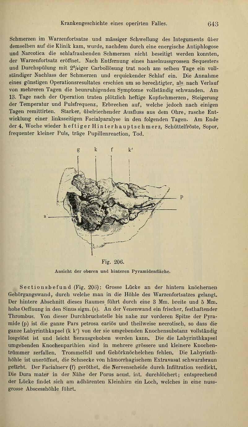 Schmerzen im Warzenfortsatze und massiger Schwellung des Integuments über demselben auf die Klinik kam, wurde, nachdem durch eine energische Antiphlogose und Narcotica die schlafraubenden Schmerzen nicht beseitigt werden konnten, der Warzenfortsatz eröffnet. Nach Entfernung eines haselnussgrossen Sequesters und Durchspülung mit 2°/oiger Carbollösung trat noch am selben Tage ein voll- ständiger Nachlass der Schmerzen und erquickender Schlaf ein. Die Annahme eines günstigen Operationsresultates erschien um so berechtigter, ah nach Verlauf von mehreren Tagen die beunruhigenden Symptome vollständig schwanden. Am 13. Tage nach der Operation traten plötzlich heftige Kopfschmerzen, Steigerung der Temperatur und Pulsfrequenz, Erbrechen auf, welche jedoch nach einigen Tagen remittirten. Starker, übelriechender Ausfluss aus dem Ohre, rasche Ent- wicklung einer linksseitigen Facialparalyse in den folgenden Tagen. Am Ende der 4. Woche wieder heftigerHinterhauptschmerz, Schüttelfröste, Sopor, frequenter kleiner Puls, träge Pupillenreaction, Tod. Fig. 206. Ansicht der oberen und hinteren Pyramidenfläehe. Sectionsbefund (Fig. 206): Grosse Lücke an der hintern knöchernen Gehörgangswand, durch welche man in die Höhle des Warzenfortsatzes gelangt. Der hintere Abschnitt dieses Raumes führt durch eine 3 Mm. breite und 5 Mm. hohe Oeffnung in den Sinus sigm. (s). An der Venenwand ein frischer, festhaftender Thrombus. Von dieser Durchbruchstelle bis nahe zur vorderen Spitze der Pyra- mide (p) ist die ganze Pars petrosa cariös und theilweise necrotisch, so dass die ganze Labyrinthkapsel (k k') von der sie umgebenden Knochensubstanz vollständig losgelöst ist und leicht herausgehoben werden kann. Die die Labyrinthkapsel umgebenden Knochenparthien sind in mehrere grössere und kleinere Knochen- trümmer zerfallen. Trommelfell und Gehörknöchelchen fehlen. Die Labyrinth- höhle ist uneröffnet, die Schnecke von hämorrbagischem Extravasat schwarzbraun gefärbt. Der Facialnerv (f) geröthet, die Nervenscheide durch Infiltration verdickt. Die Dura mater in der Nähe der Porus acust. int. durchlöchert; entsprechend der Lücke findet sich am adhärenten Kleinhirn ein Loch, welches in eine nuss- grosse Abscesshöhle führt.