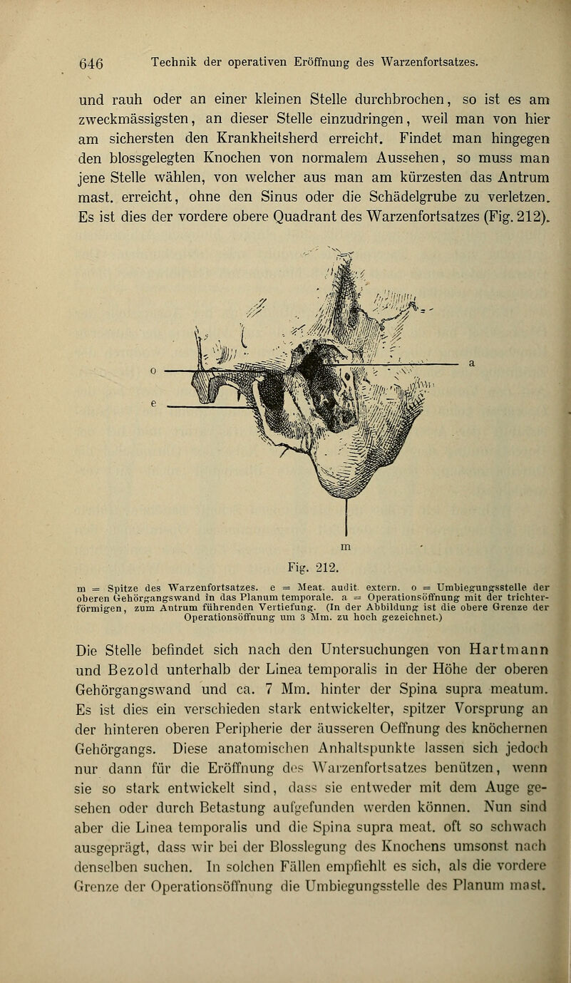 und rauh oder an einer kleinen Stelle durchbrochen, so ist es am zweckmässigsten, an dieser Stelle einzudringen, weil man von hier am sichersten den Krankheitsherd erreicht. Findet man hingegen den blossgelegten Knochen von normalem Aussehen, so muss man jene Stelle wählen, von welcher aus man am kürzesten das Antrum mast. erreicht, ohne den Sinus oder die Schädelgrube zu verletzen. Es ist dies der vordere obere Quadrant des Warzenfortsatzes (Fig. 212). Fig. 212. m = Spitze des Warzenfortsatzes, e = Meat. audit. extern, o = Umbiegungsstelle der oberen Gehörgangswand in das Planum temporale, a = Operationsöffnung mit der trichter- förmigen, zum Antrum führenden Vertiefung. (In der Abbildung ist die obere Grenze der Operationsöffnung um 3 Mm. zu hoch gezeichnet.) Die Stelle befindet sich nach den Untersuchungen von Hartmann und Bezold unterhalb der Linea temporalis in der Höhe der oberen Gehörgangswand und ca. 7 Mm. hinter der Spina supra meatum. Es ist dies ein verschieden stark entwickelter, spitzer Vorsprung an der hinteren oberen Peripherie der äusseren Oeffnung des knöchernen Gehörgangs. Diese anatomischen Anhaltspunkte lassen sich jedoch nur dann für die Eröffnung des Warzenfortsatzes benützen, wenn sie so stark entwickelt sind, dass sie entweder mit dem Auge ge- sehen oder durch Betastung aufgefunden werden können. Nun sind aber die Linea temporalis und die Spina supra meat. oft so schwach ausgeprägt, dass wir bei der Blosslegung des Knochens umsonst nach denselben suchen. In solchen Fällen empfiehlt es sich, als die vordere Grenze der Operationsöffnung die Umbiegungsstelle des Planum mast.