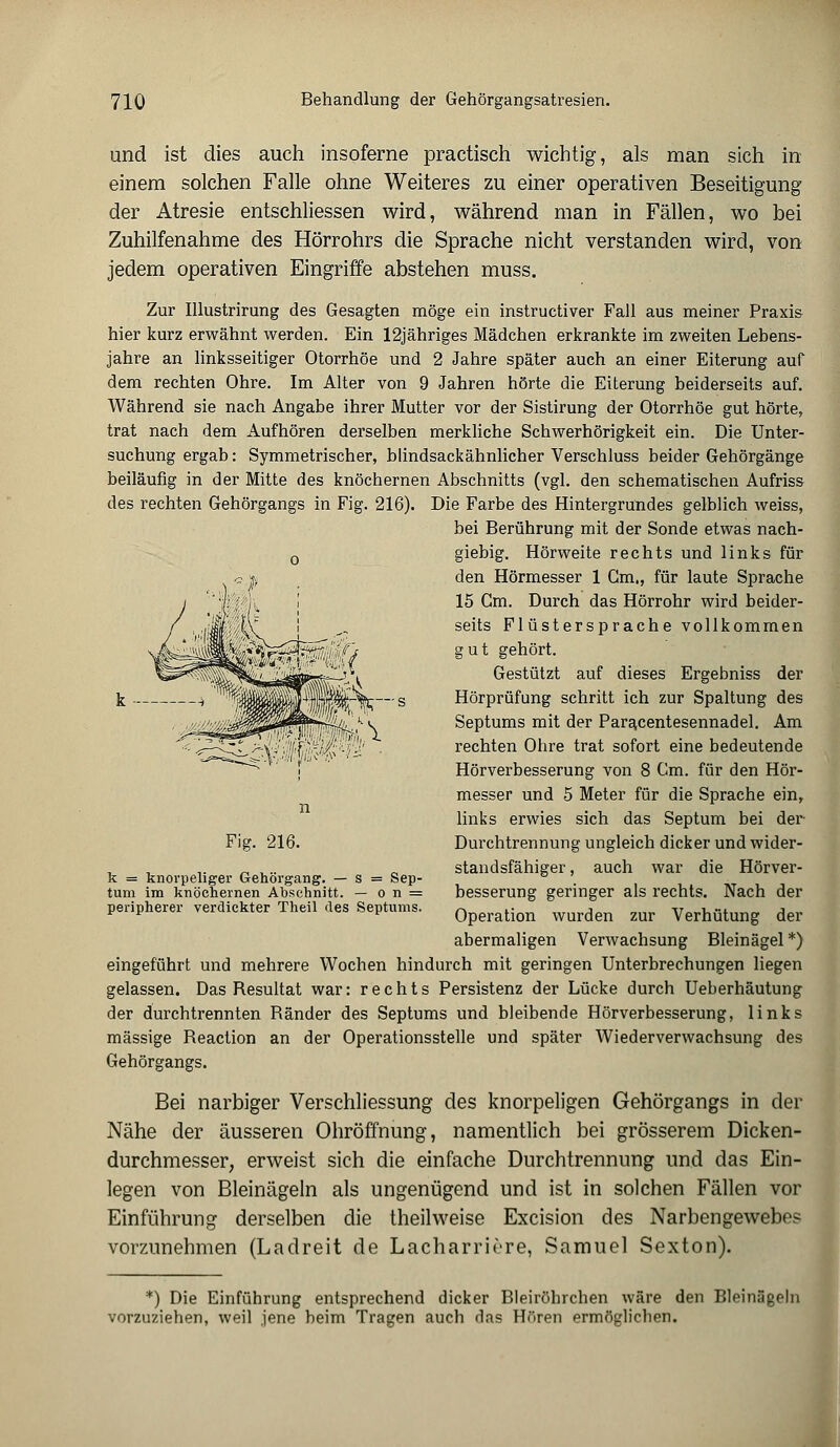 und ist dies auch insoferne practisch wichtig, als man sich in einem solchen Falle ohne Weiteres zu einer operativen Beseitigung der Atresie entschliessen wird, während man in Fällen, wo bei Zuhilfenahme des Hörrohrs die Sprache nicht verstanden wird, von jedem operativen Eingriffe abstehen muss. Zur Illustrirung des Gesagten möge ein instructiver Fall aus meiner Praxis hier kurz erwähnt werden. Ein 12jähriges Mädchen erkrankte im zweiten Lebens- jahre an linksseitiger Otorrhöe und 2 Jahre später auch an einer Eiterung auf dem rechten Ohre. Im Alter von 9 Jahren hörte die Eiterung beiderseits auf. Während sie nach Angabe ihrer Mutter vor der Sistirung der Otorrhöe gut hörte, trat nach dem Aufhören derselben merkliche Schwerhörigkeit ein. Die Unter- suchung ergab: Symmetrischer, blindsackähnlicher Verschluss beider Gehörgänge beiläufig in der Mitte des knöchernen Abschnitts (vgl. den schematischen Aufriss des rechten Gehörgangs in Fig. 216). Die Farbe des Hintergrundes gelblich weiss, bei Berührung mit der Sonde etwas nach- 0 giebig. Hörweite rechts und links für den Hörmesser 1 Gm., für laute Sprache 15 Cm. Durch das Hörrohr wird beider- seits Flüstersprache vollkommen gut gehört. Gestützt auf dieses Ergebniss der Hörprüfung schritt ich zur Spaltung des Septums mit der Paracentesennadel. Am rechten Ohre trat sofort eine bedeutende Hörverbesserung von 8 Cm. für den Hör- messer und 5 Meter für die Sprache ein, links erwies sich das Septum bei der Durchtrennung ungleich dicker und wider- standsfähiger , auch war die Hörver- besserung geringer als rechts. Nach der Operation wurden zur Verhütung der abermaligen Verwachsung Bleinägel *) eingeführt und mehrere Wochen hindurch mit geringen Unterbrechungen liegen gelassen. Das Resultat war: rechts Persistenz der Lücke durch Ueberhäutung der durchtrennten Ränder des Septums und bleibende Hörverbesserung, links massige Reaction an der Operationsstelle und später Wiederverwachsung des Gehörgangs. Bei narbiger Verschliessung des knorpeligen Gehörgangs in der Nähe der äusseren Ohröffnung, namentlich bei grösserem Dicken- durchmesser, erweist sich die einfache Durchtrennung und das Ein- legen von Bleinägeln als ungenügend und ist in solchen Fällen vor Einführung derselben die theilweise Excision des Narbengewebes vorzunehmen (Ladreit de Lacharriere, Samuel Sexton). Fig. 216. k = knorpeliger Gehörgang. — s = Sep- tum im knöchernen Abschnitt. — o n = peripherer verdickter Theil des Septums. *) Die Einführung entsprechend dicker Bleiröhrchen wäre den Bleinägeln vorzuziehen, weil jene beim Tragen auch das Hören ermöglichen.