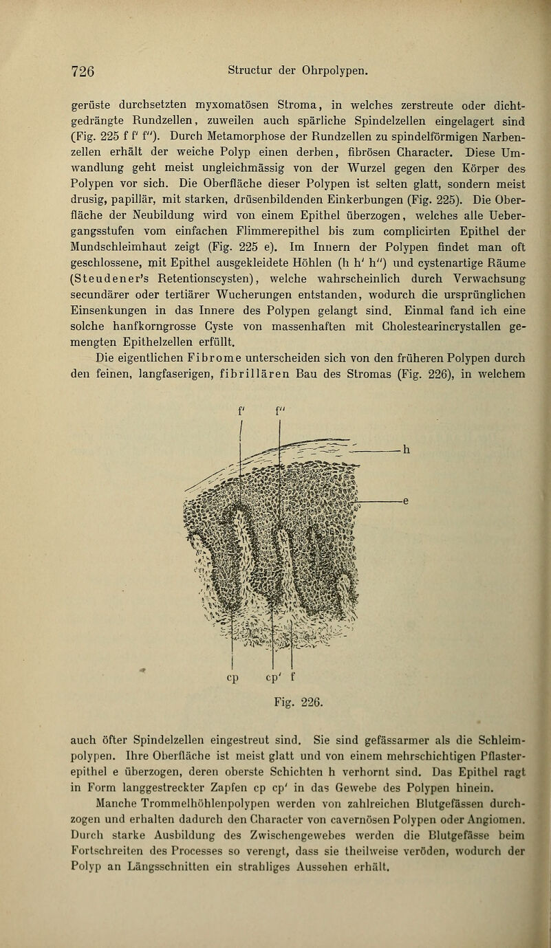 gerüste durchsetzten myxomatösen Stroma, in welches zerstreute oder dicht- gedrängte Rundzellen, zuweilen auch spärliche Spindelzellen eingelagert sind (Fig. 225 f P i). Durch Metamorphose der Rundzellen zu spindelförmigen Narben- zellen erhält der weiche Polyp einen derben, fibrösen Character. Diese Um- wandlung geht meist ungleichmässig von der Wurzel gegen den Körper des Polypen vor sich. Die Oberfläche dieser Polypen ist selten glatt, sondern meist drusig, papillär, mit starken, drüsenbildenden Einkerbungen (Fig. 225). Die Ober- fläche der Neubildung wird von einem Epithel überzogen, welches alle Ueber- gangsstufen vom einfachen Flimmerepithel bis zum complicirten Epithel der Mundschleimhaut zeigt (Fig. 225 e). Im Innern der Polypen findet man oft geschlossene, mit Epithel ausgekleidete Höhlen (h h' h) und cystenartige Räume (Steudener's Retentionscysten), welche wahrscheinlich durch Verwachsung secundärer oder tertiärer Wucherungen entstanden, wodurch die ursprünglichen Einsenkungen in das Innere des Polypen gelangt sind. Einmal fand ich eine solche hanfkorngrosse Cyste von massenhaften mit Gholestearincrystallen ge- mengten Epithelzellen erfüllt. Die eigentlichen Fibrome unterscheiden sich von den früheren Polypen durch den feinen, langfaserigen, fibrillären Bau des Stromas (Fig. 226), in welchem auch öfter Spindelzellen eingestreut sind. Sie sind gefässarmer als die Schleim- polypen. Ihre Oberfläche ist meist glatt und von einem mehrschichtigen Pflaster- epithel e überzogen, deren oberste Schichten h verhornt sind. Das Epithel ragt in Form langgestreckter Zapfen cp cp' in das Gewebe des Polypen hinein. Manche Trommelhöhlenpolypen werden von zahlreichen Blutgefässen durch- zogen und erhalten dadurch den Character von cavernösen Polypen oder Angiomen. Durch starke Ausbildung des Zwischengewebes werden die Blutgefässe beim Fortschreiten des Processes so verengt, dass sie theilweise veröden, wodurch der Polyp an Längsschnitten ein strahliges Aussehen erhält.