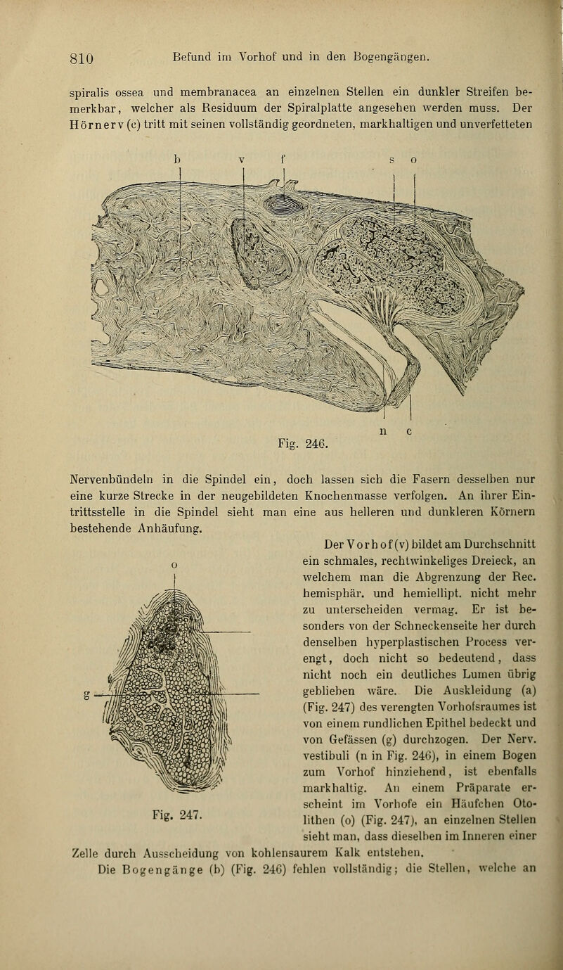 spiralis ossea und membranacea an einzelnen Stellen ein dunkler Streifen be- merkbar, welcher als Residuum der Spiralplatte angesehen werden muss. Der Hörn er v (c) tritt mit seinen vollständig geordneten, markhaltigen und unverfetteten Fig. 246. Nervenbündeln in die Spindel ein, doch lassen sich die Fasern desselben nur eine kurze Strecke in der neugebildeten Knochenmasse verfolgen. An ihrer Ein- trittsstelle in die Spindel sieht man eine aus helleren und dunkleren Körnern bestehende Anhäufung. DerVorhof(v) bildet am Durchschnitt ein schmales, rechtwinkeliges Dreieck, an welchem man die Abgrenzung der Rec. hemisphär. und hemiellipt. nicht mehr zu unterscheiden vermag. Er ist be- sonders von der Schneckenseite her durch denselben hyperplastischen Process ver- engt , doch nicht so bedeutend, dass nicht noch ein deutliches Lumen übrig geblieben wäre. Die Auskleidung (a) (Fig. 247) des verengten Vorhofsraumes ist von einem rundlichen Epithel bedeckt und von Gefässen (g) durchzogen. Der Nerv, vestibuli (n in Fig. 240), in einem Bogen zum Vorhof hinziehend, ist ebenfalls markhaltig. An einem Präparate er- scheint im Vorhofe ein Häufchen Oto- lithen (o) (Fig. 247), an einzelnen Stellen sieht man, dass dieselben im Inneren einer Zelle durch Ausscheidung von kohlensaurem Kalk entstehen. Die Bogengänge (b) (Fig. 24G) fehlen vollständig; die Stellen, welche an Fig. 247.