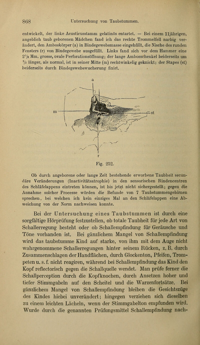 Untersuchung von Taubstummen. entwickelt, der linke Acusticusstamm gelatinös entartet. — Bei einem 11jährigen, angeblich taub geborenen Mädchen fand ich das rechte Trommelfell narbig ver- ändert, den Amboskörper (a) in Bindegewebsmasse eingehüllt, die Nische des runden Fensters (r) von Bindegewebe ausgefüllt. Links fand sich vor dem Hammer eine 2!/2 Mm. grosse, ovale Perforationsöffnung; der lange Ambosschenkel beiderseits um ll% länger, als normal, ist in seiner Mitte (m) rechtwinkelig geknickt; der Stapes (st) beiderseits durch Bindegewebswucherung fixirt. Fig. 252. Ob durch angeborene oder lange Zeit bestehende erworbene Taubheit secun- däre Veränderungen (Inactivitätsatrophie) in den sensorischen Bindencentren des Schläfelappens eintreten können, ist bis jetzt nicht sichergestellt; gegen die Annahme solcher Processe würden die Befunde von 7 Taubstummengebirnen sprechen, bei welchen ich kein einziges Mal an den Schläfelappen eine Ab- weichung von der Norm nachweisen konnte. Bei der Untersuchung eines Taubstummen ist durch eine sorgfältige Hörprüfung festzustellen, ob totale Taubheit für jede Art von Schallerregung besteht oder ob Schallempfindung für Geräusche und Töne vorhanden ist. Bei gänzlichem Mangel von Schallempfindung wird das taubstumme Kind auf starke, von ihm mit dem Auge nicht wahrgenommene Schallerregungen hinter seinem Bücken, z. B. durch Zusammenschlagen der Handflächen, durch Glockenton, Pfeifen, Trom- peten u. s. f. nicht reagiren, während bei Schallempfindung das Kind den Kopf reflectorisch gegen die Schallquelle wendet. Man prüfe ferner die Schallperception durch die Kopfknochen, durch Ansetzen hoher und tiefer Stimmgabeln auf den Scheitel und die Warzenfortsätze. Bei gänzlichem Mangel von Schallempfindung bleiben die Gesichtszüge des Kindes hiebei unverändert; hingegen verziehen sich dieselben zu einem leichten Lächeln, wenn der Stimmgabelton empfunden wird. Wurde durch die genannten Prüfungsmittel Schallempfindung nach-