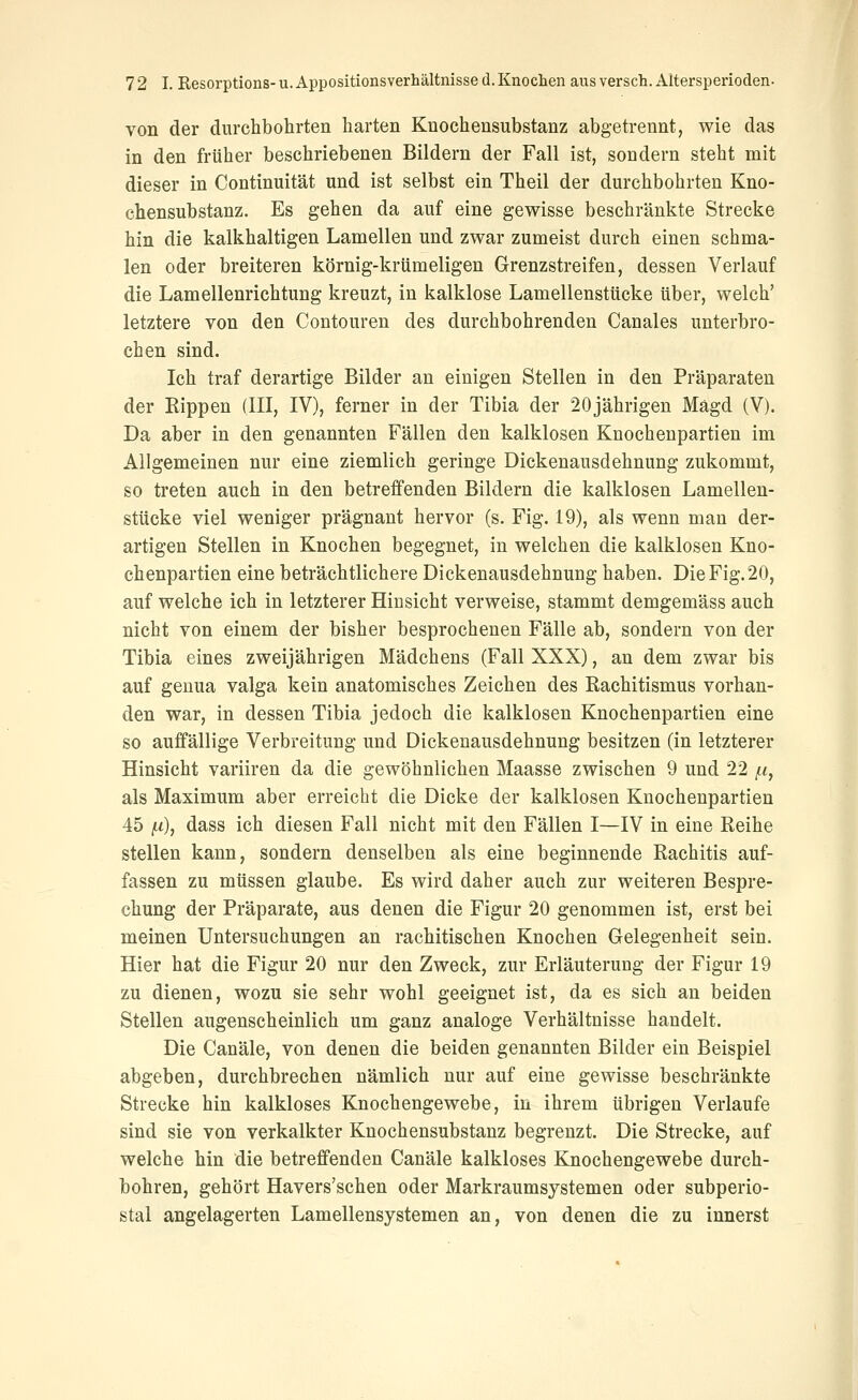 von der durchbohrten harten Kuochensubstanz abgetrennt, wie das in den früher beschriebenen Bildern der Fall ist, sondern steht mit dieser in Continuität und ist selbst ein Theil der durchbohrten Kno- chensubstanz. Es gehen da auf eine gewisse beschränkte Strecke hin die kalkhaltigen Lamellen und zwar zumeist durch einen schma- len oder breiteren körnig-krümeligen Grenzstreifen, dessen Verlauf die Lamellenrichtung kreuzt, in kalklose Lamellenstücke über, welch' letztere von den Contouren des durchbohrenden Canales unterbro- chen sind. Ich traf derartige Bilder an einigen Stellen in den Präparaten der Rippen (III, IV), ferner in der Tibia der 20jährigen Magd (V). Da aber in den genannten Fällen den kalklosen Knochenpartien im Allgemeinen nur eine ziemlich geringe Dickenausdehnung zukommt, so treten auch in den betreffenden Bildern die kalklosen Lamellen- stücke viel weniger prägnant hervor (s. Fig. 19), als wenn man der- artigen Stellen in Knochen begegnet, in welchen die kalklosen Kno- chenpartien eine beträchtlichere Dickenausdehnung haben. Die Fig. 20, auf welche ich in letzterer Hinsicht verweise, stammt demgemäss auch nicht von einem der bisher besprochenen Fälle ab, sondern von der Tibia eines zweijährigen Mädchens (Fall XXX), an dem zwar bis auf geuua valga kein anatomisches Zeichen des Eachitismus vorhan- den war, in dessen Tibia jedoch die kalklosen Knochenpartien eine so auffällige Verbreitung und Dickenausdehnung besitzen (in letzterer Hinsicht variiren da die gewöhnlichen Maasse zwischen 9 und 22 /<, als Maximum aber erreicht die Dicke der kalklosen Knochenpartien 45 [x), dass ich diesen Fall nicht mit den Fällen I—IV in eine Reihe stellen kann, sondern denselben als eine beginnende Rachitis auf- fassen zu müssen glaube. Es wird daher auch zur weiteren Bespre- chung der Präparate, aus denen die Figur 20 genommen ist, erst bei meinen Untersuchungen an rachitischen Knochen Gelegenheit sein. Hier hat die Figur 20 nur den Zweck, zur Erläuterung der Figur 19 zu dienen, wozu sie sehr wohl geeignet ist, da es sich an beiden Stellen augenscheinlich um ganz analoge Verhältnisse handelt. Die Canäle, von denen die beiden genannten Bilder ein Beispiel abgeben, durchbrechen nämlich nur auf eine gewisse beschränkte Strecke hin kalkloses Knochengewebe, in ihrem übrigen Verlaufe sind sie von verkalkter Knochensubstanz begrenzt. Die Strecke, auf welche hin die betreffenden Canäle kalkloses Knochengewebe durch- bohren, gehört Havers'schen oder Markraumsystemen oder subperio- stal angelagerten Lamellensystemen an, von denen die zu innerst