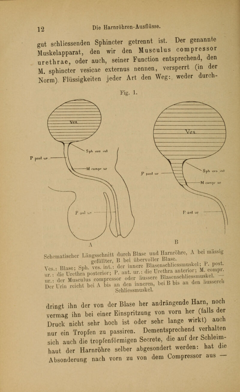 Die Harnröhren-Ausflüsse. gut schliessenden Sphincter getrennt ist. Der genannte Muskelapparat, den wir den Musculus compressor urethrae, oder auch, seiner Function entsprechend, den M sphincter vesicae externus nennen, versperrt (in der Norm) Flüssigkeiten jeder Art den Weg: weder durch- Pig. l. P posl UP ,P post ur P ant ur B Somatischer Längsschnitt durch Blase, und 5a^röhre, A bei massig gefüllter, B bei übervoller Blase. v*« . Rlase- Süh ves. int.: der innere Bläsenschliessmuskel; P. post. I^ die Urethra posterior; P. ant. ur.-. die Urethra anterior; M compr. •; ,' ■ Musculus compressor oder äussere Blasenseh hessmuske- ,;,:, ürill reicht bei A bis an den inneren, bei B bis an den äusseren Schliessmuskel. dringt ihn der von der Blase her andrängende Harn noch vermag ihn bei einer Einspritzung von vorn her (falls der Druck nicht sehr hoch ist oder sehr lange wirkt) auch nur ein Tropfen zu passiren. Dementsprechend verhalten sich auch die tropfenförmigen Secrete, die auf der Schleim- haut der Harnröhre selber abgesondert werden: hat die Absonderung nach vorn zu von dem Compressor aus -